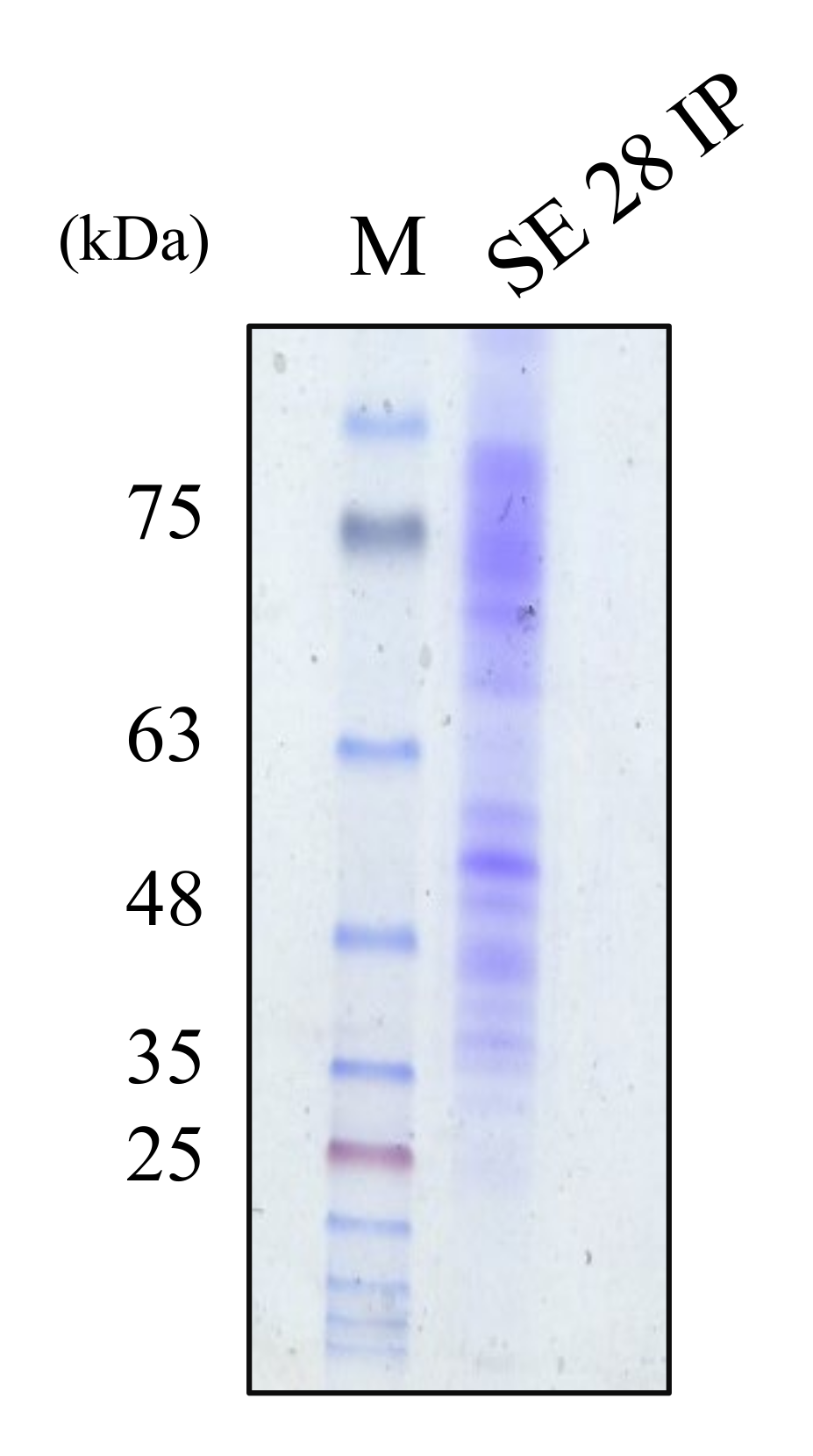 Pathogens 09 00087 g005 Pathogens 09 00087 g005