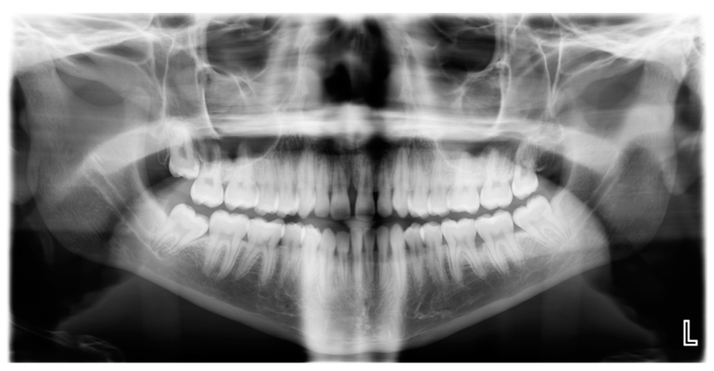 Pathogens 09 00179 g001