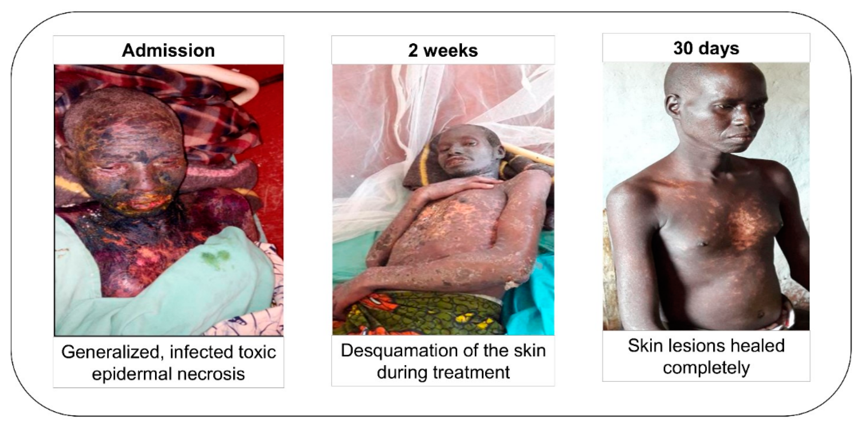 Pathogens 09 00205 g004