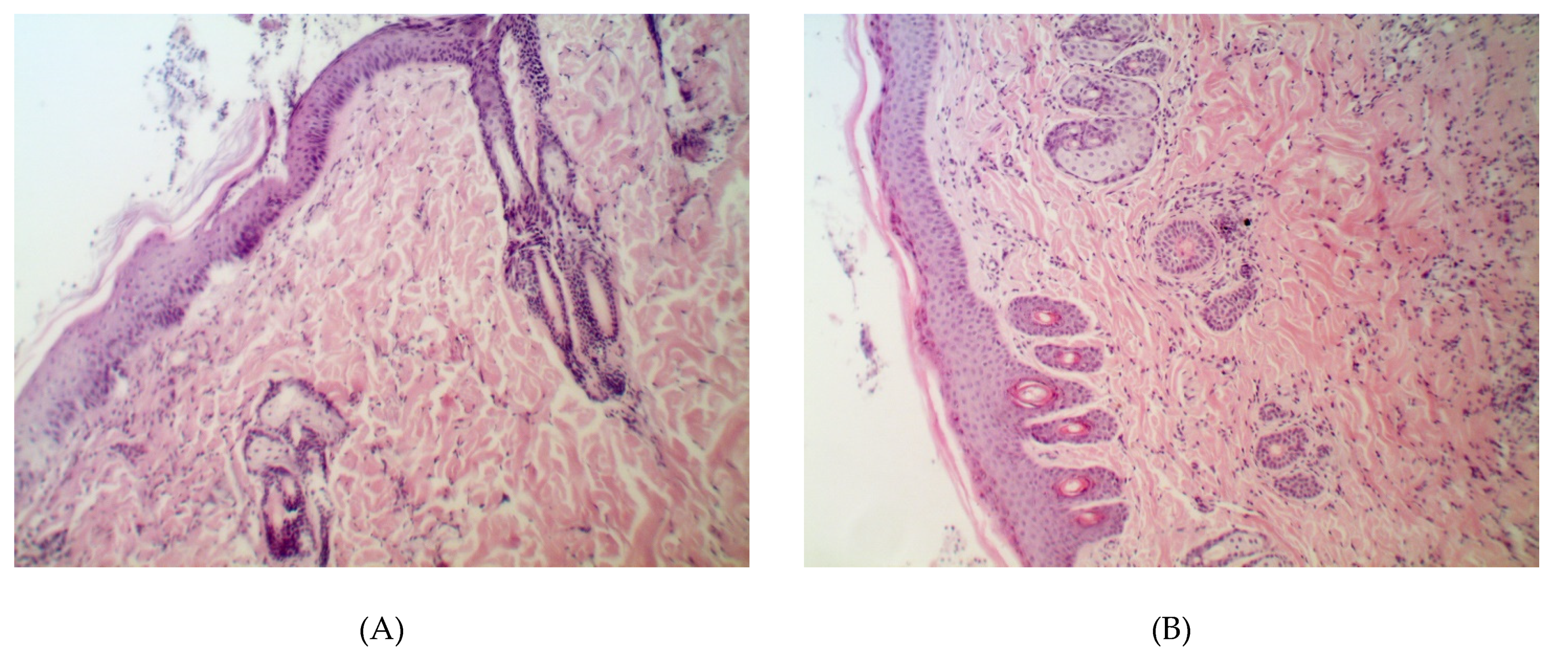 Pathogens 09 00296 g001a