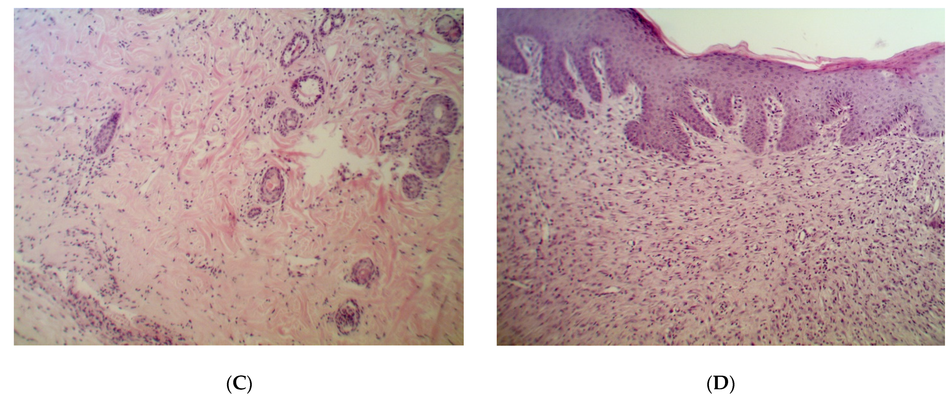 Pathogens 09 00296 g001b