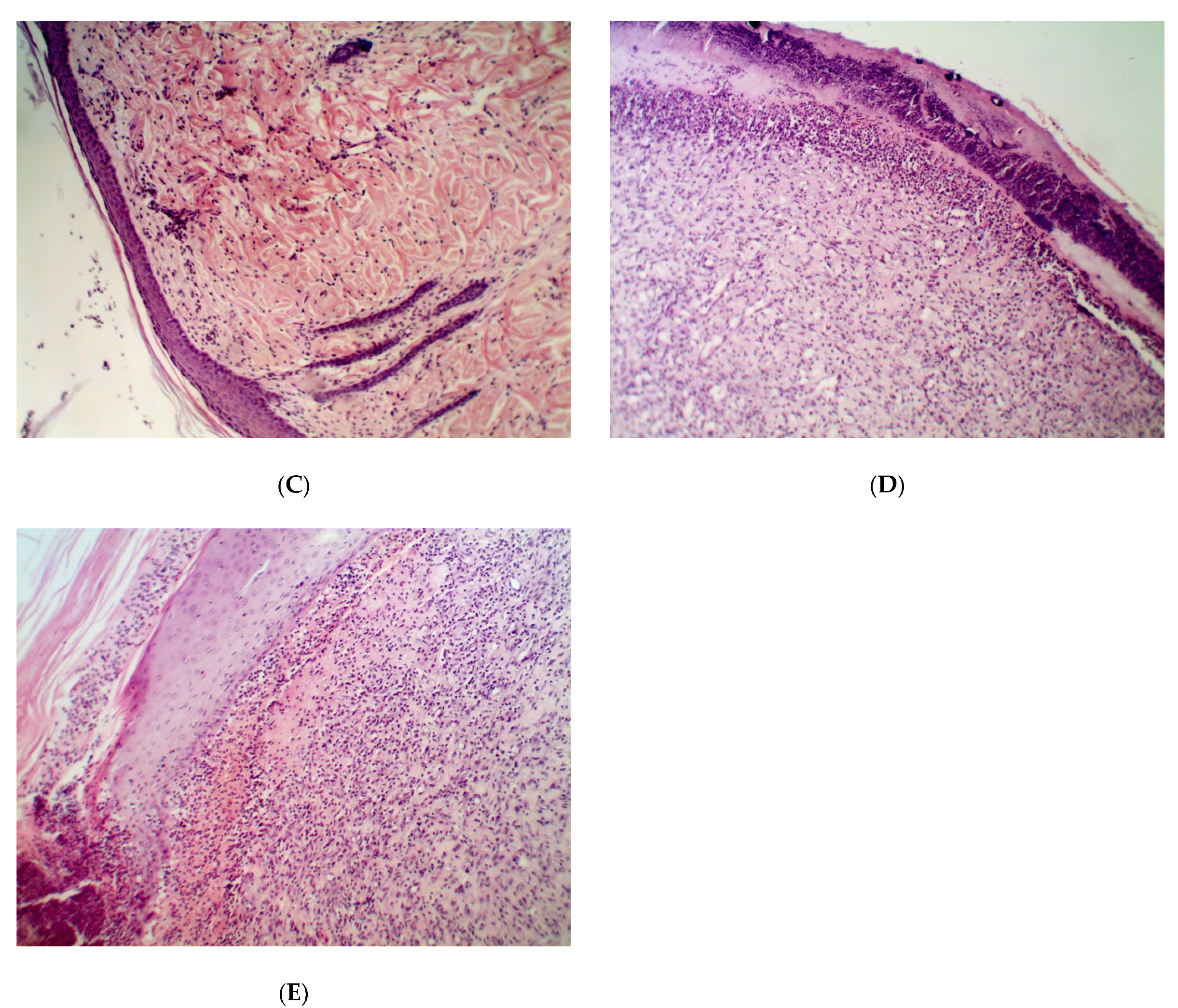Pathogens 09 00296 g005b
