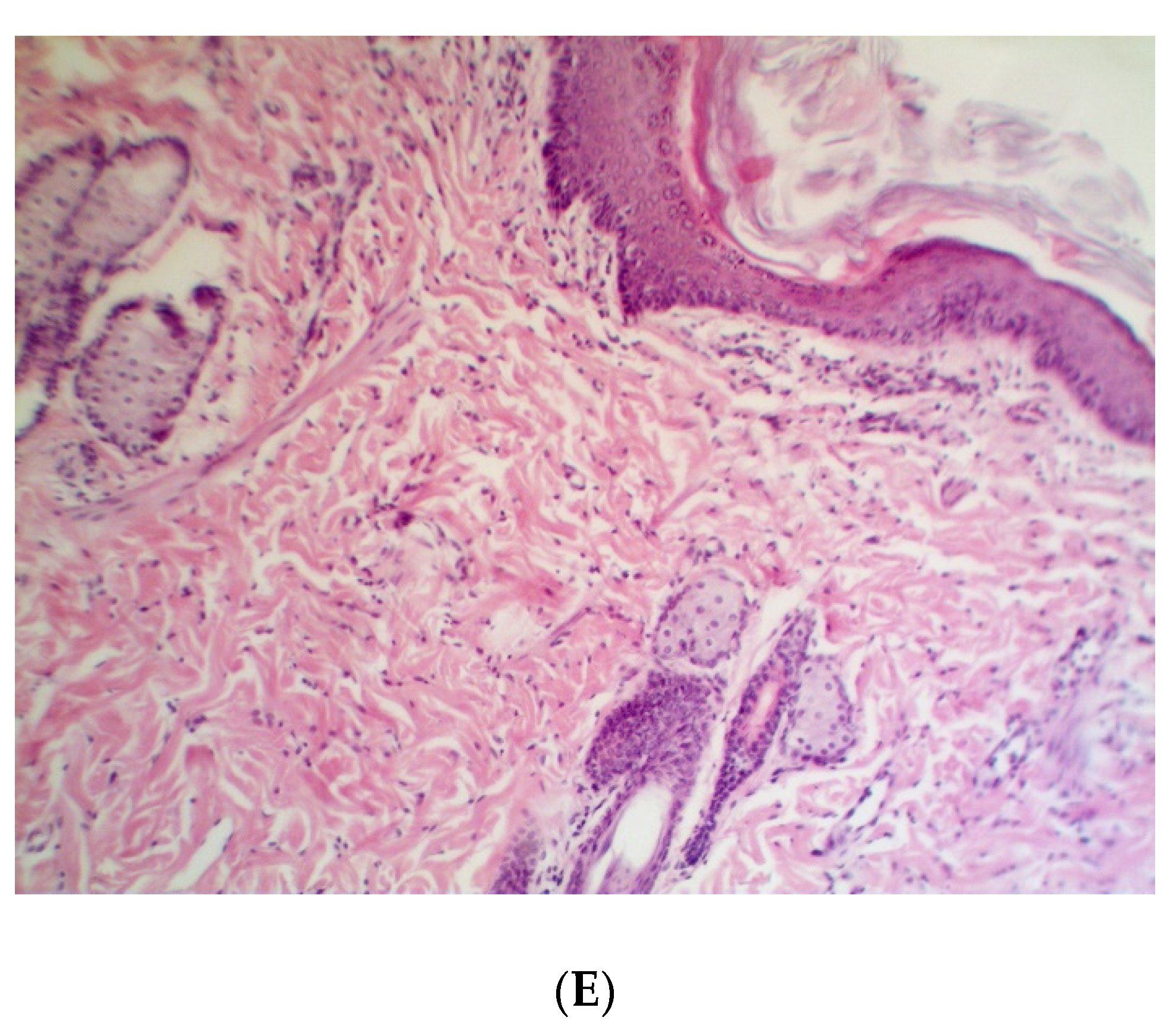 Pathogens 09 00296 g007b