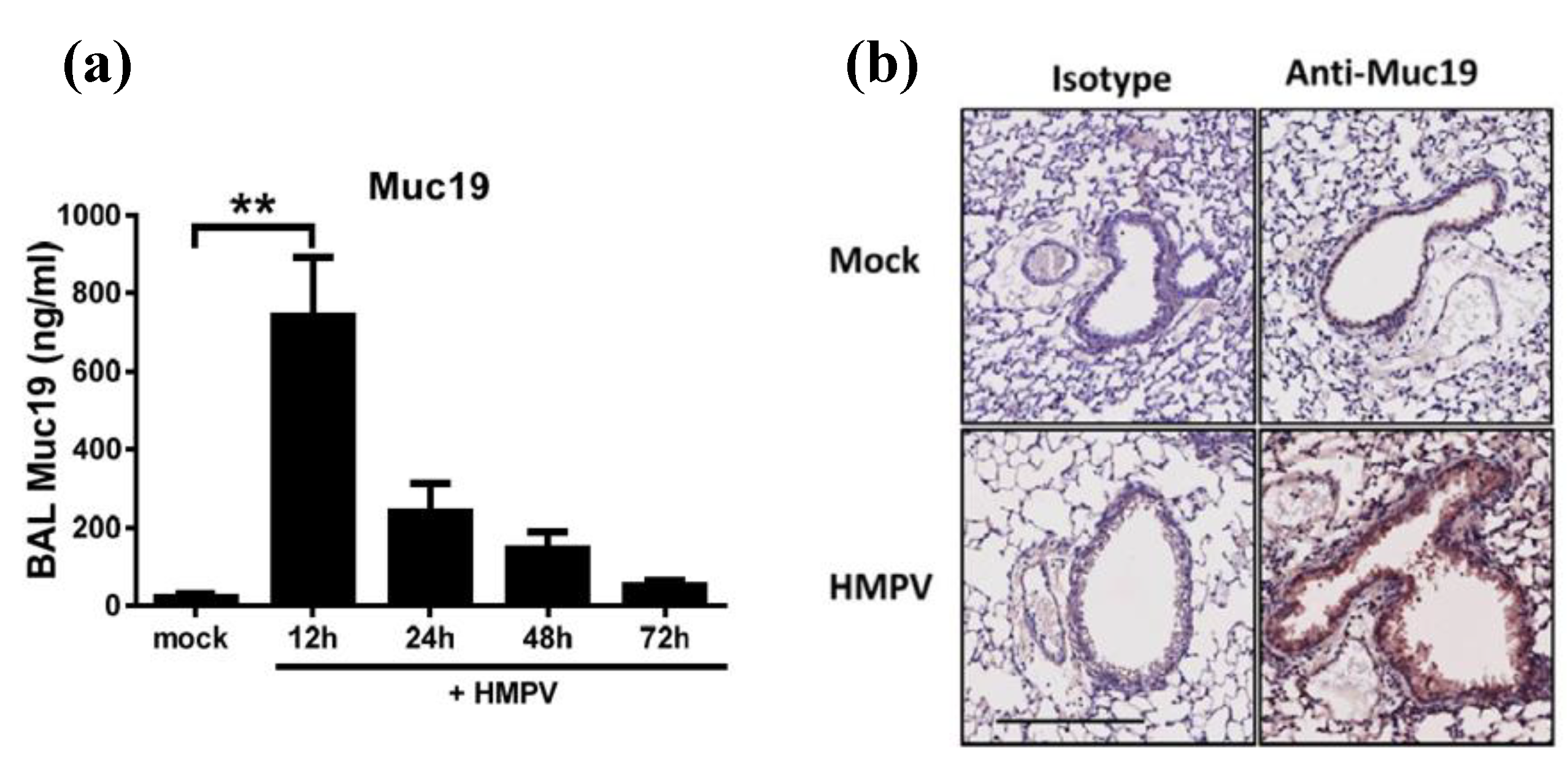 Pathogens 09 00726 g004