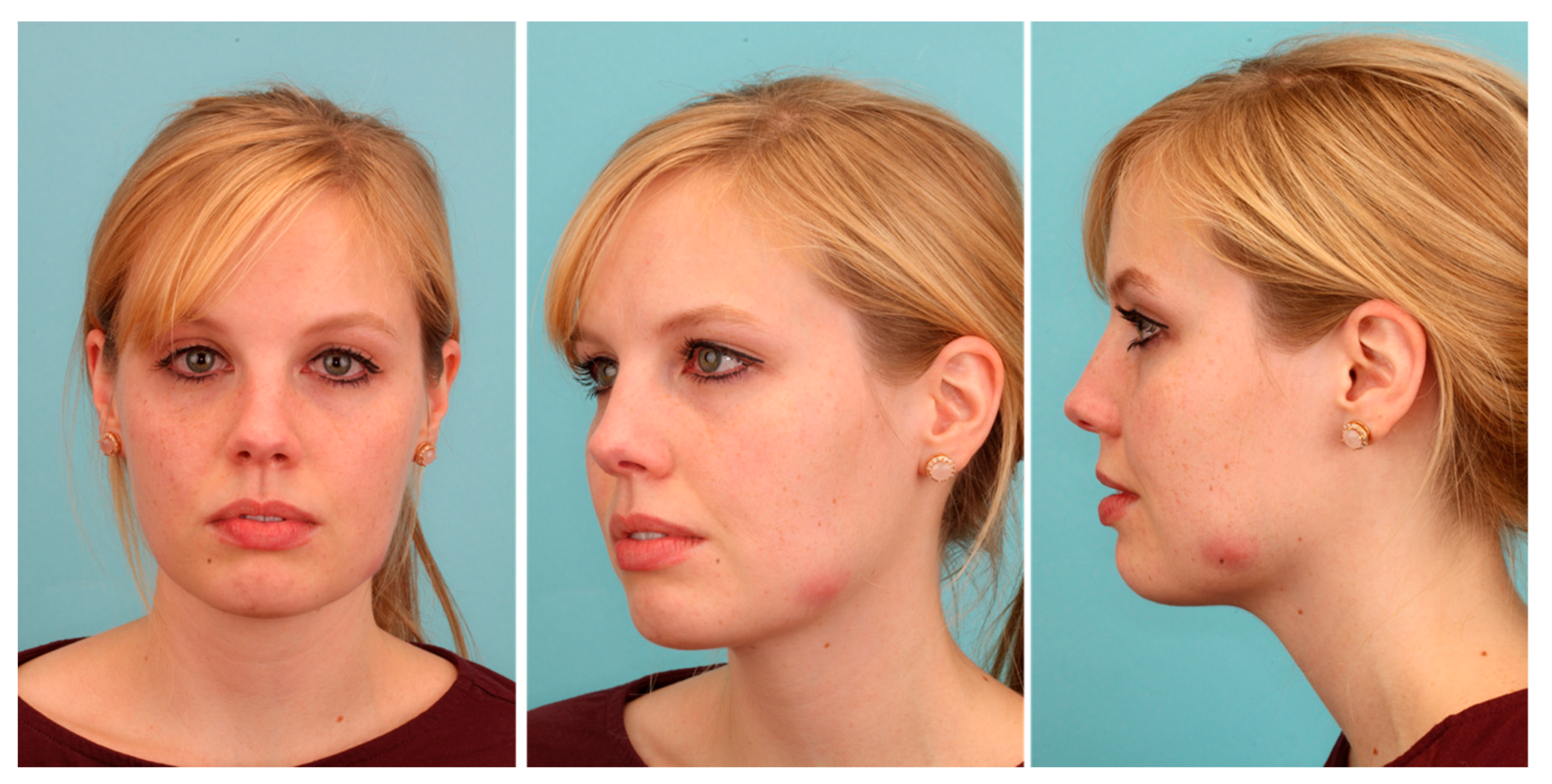 Pathogens 09 00798 g002 Pathogens 09 00798 g002