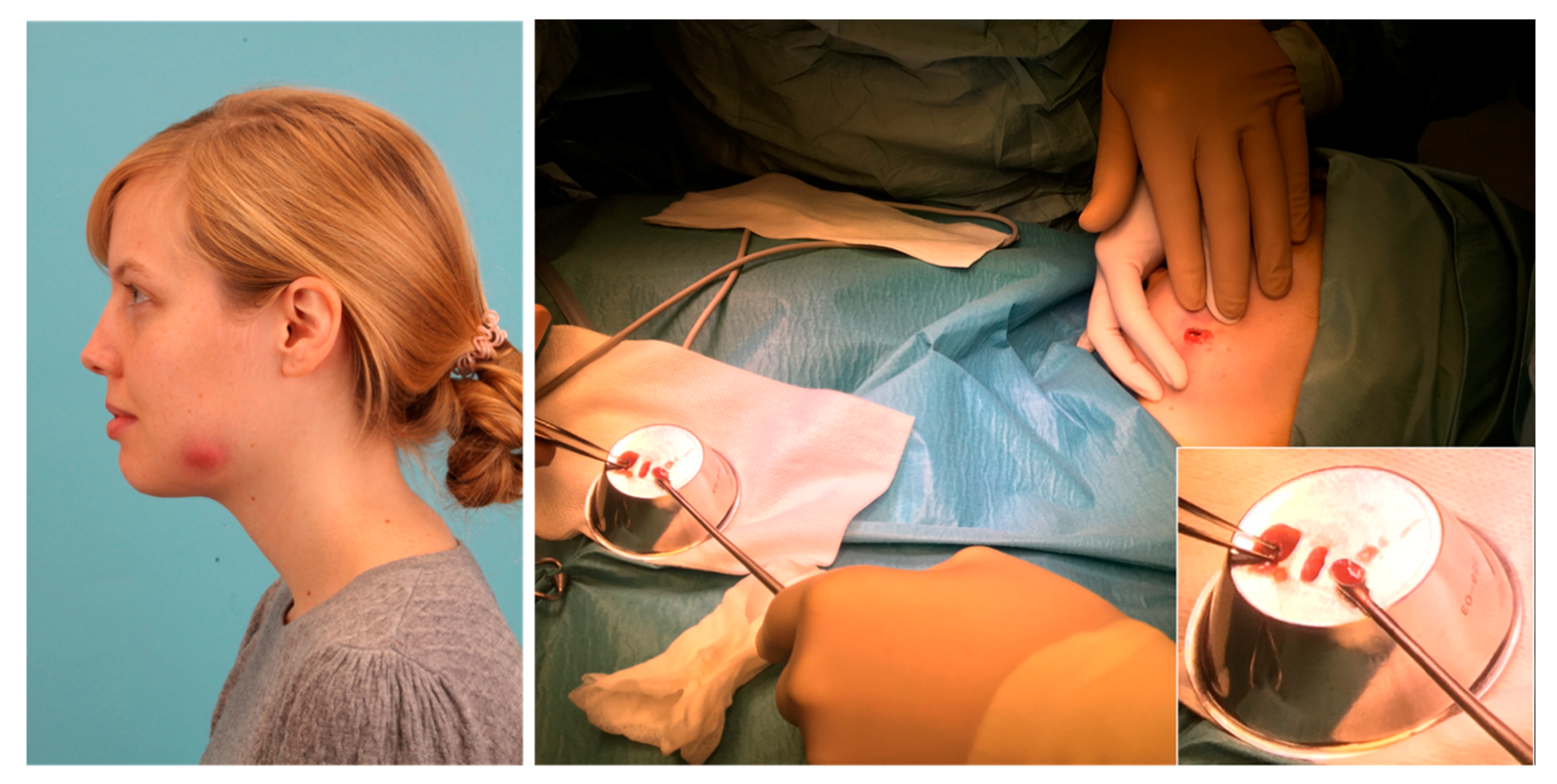 Pathogens 09 00798 g003 Pathogens 09 00798 g003