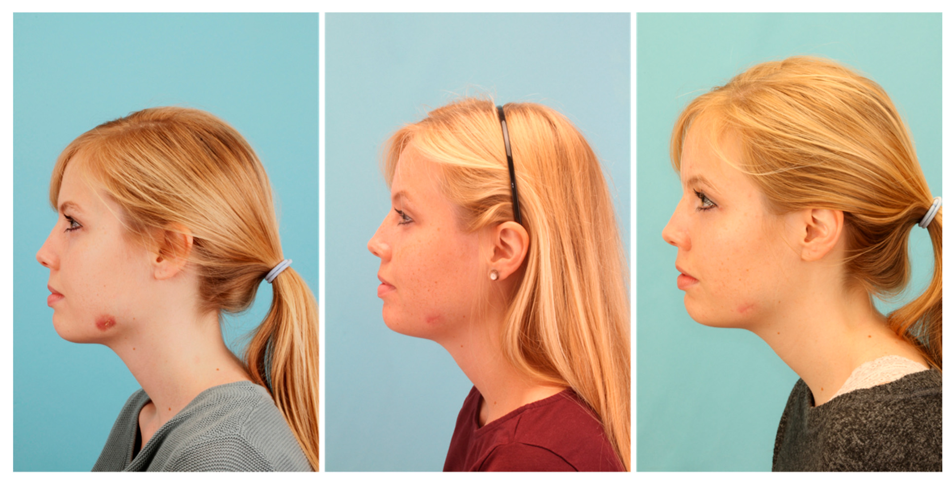 Pathogens 09 00798 g004 Pathogens 09 00798 g004