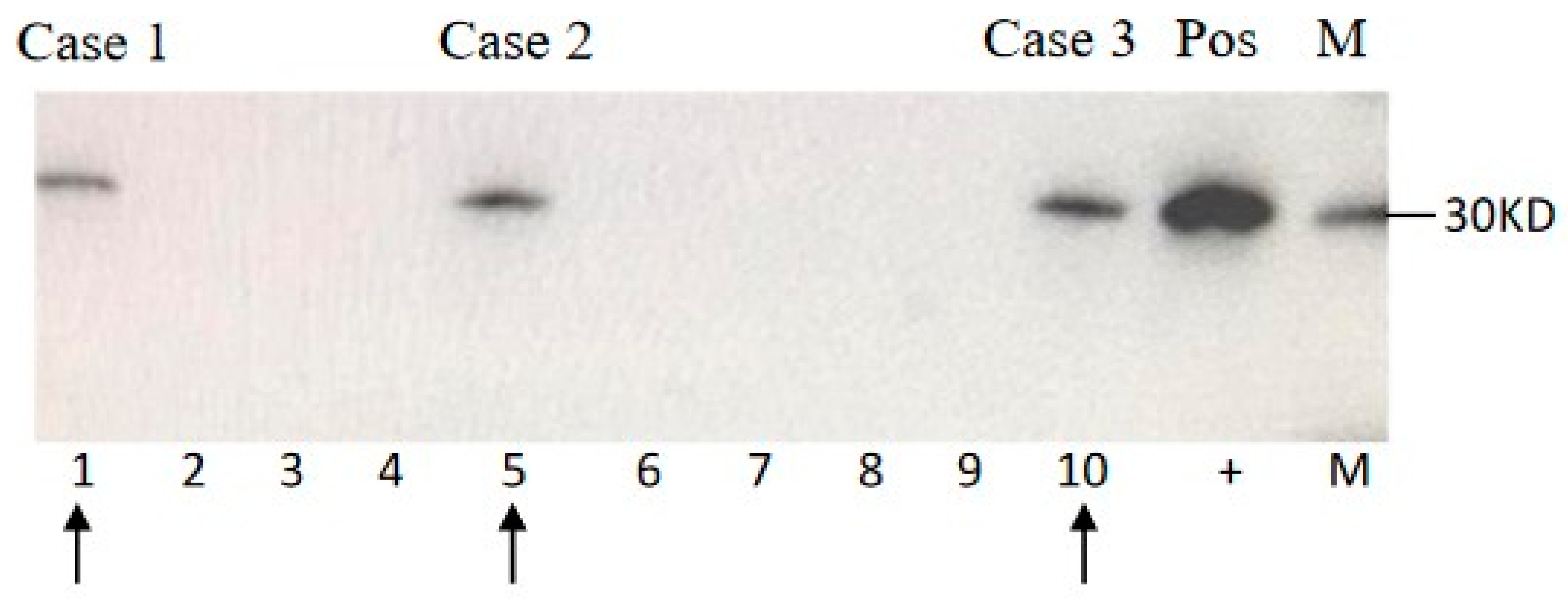 Pathogens 09 00800 g001