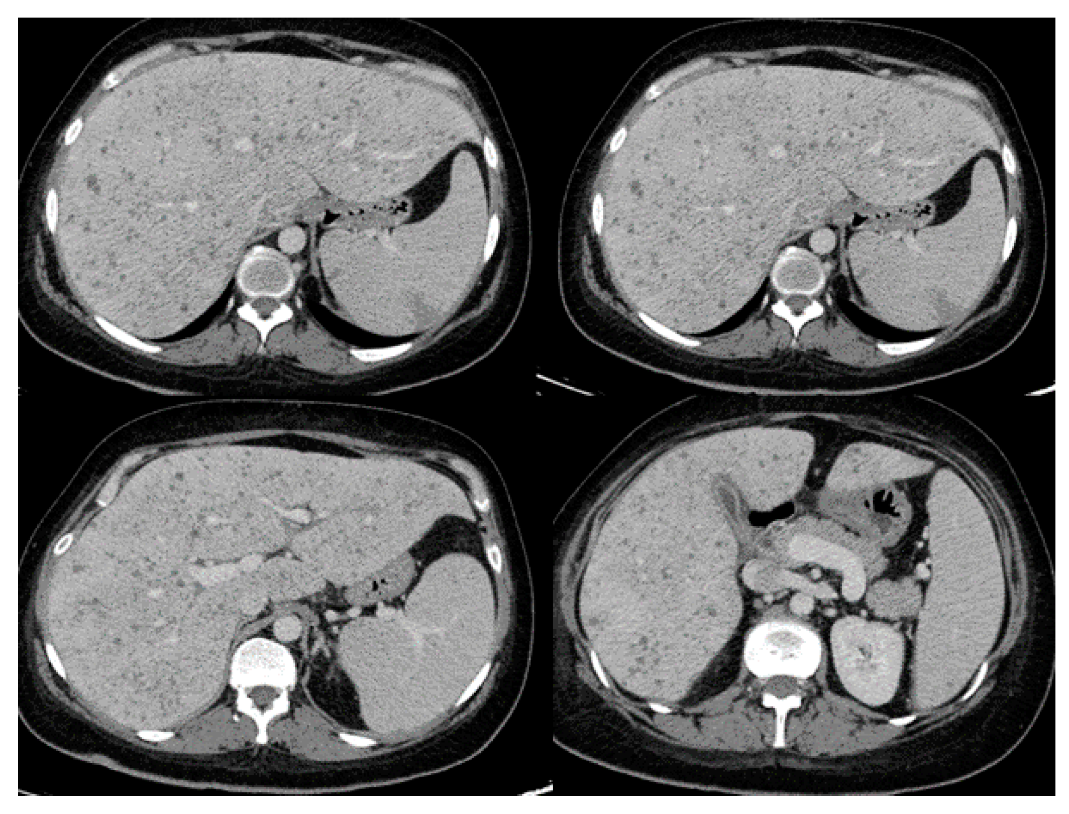 Pathogens 09 00922 g001