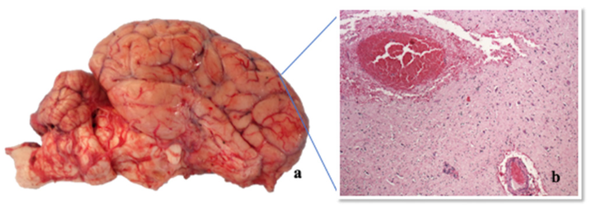 Pathogens 09 00954 g005 Pathogens 09 00954 g005