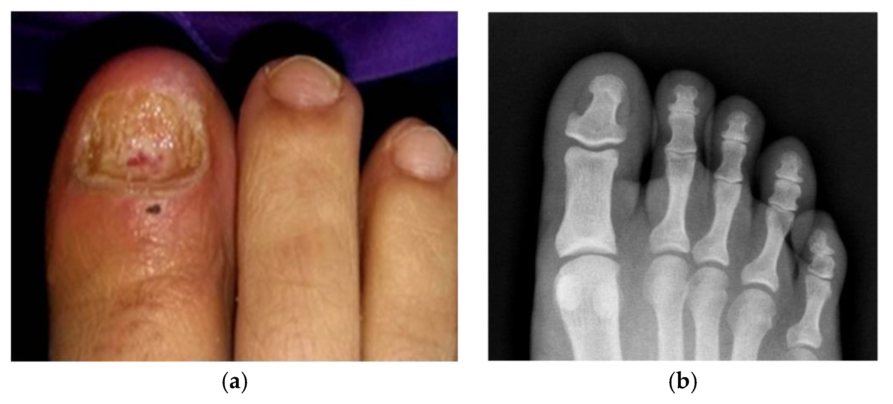 Pathogens 09 00999 g002