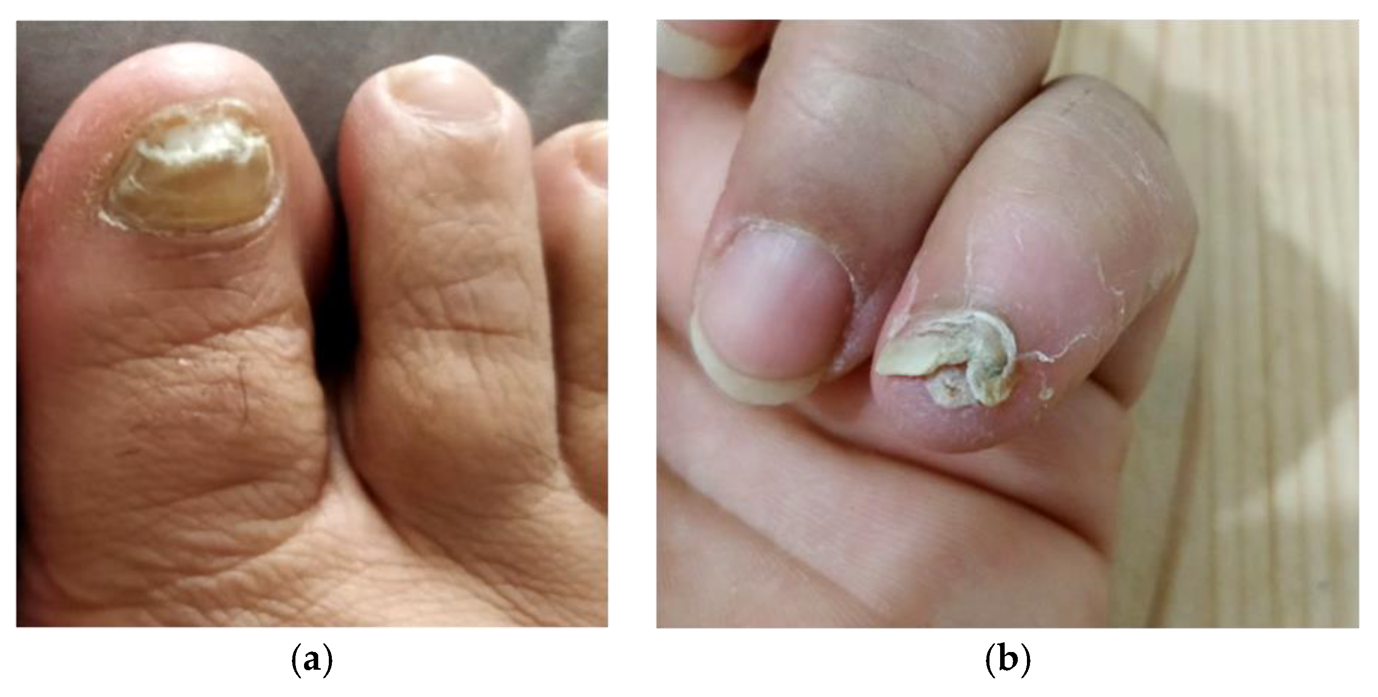 Pathogens 09 00999 g003