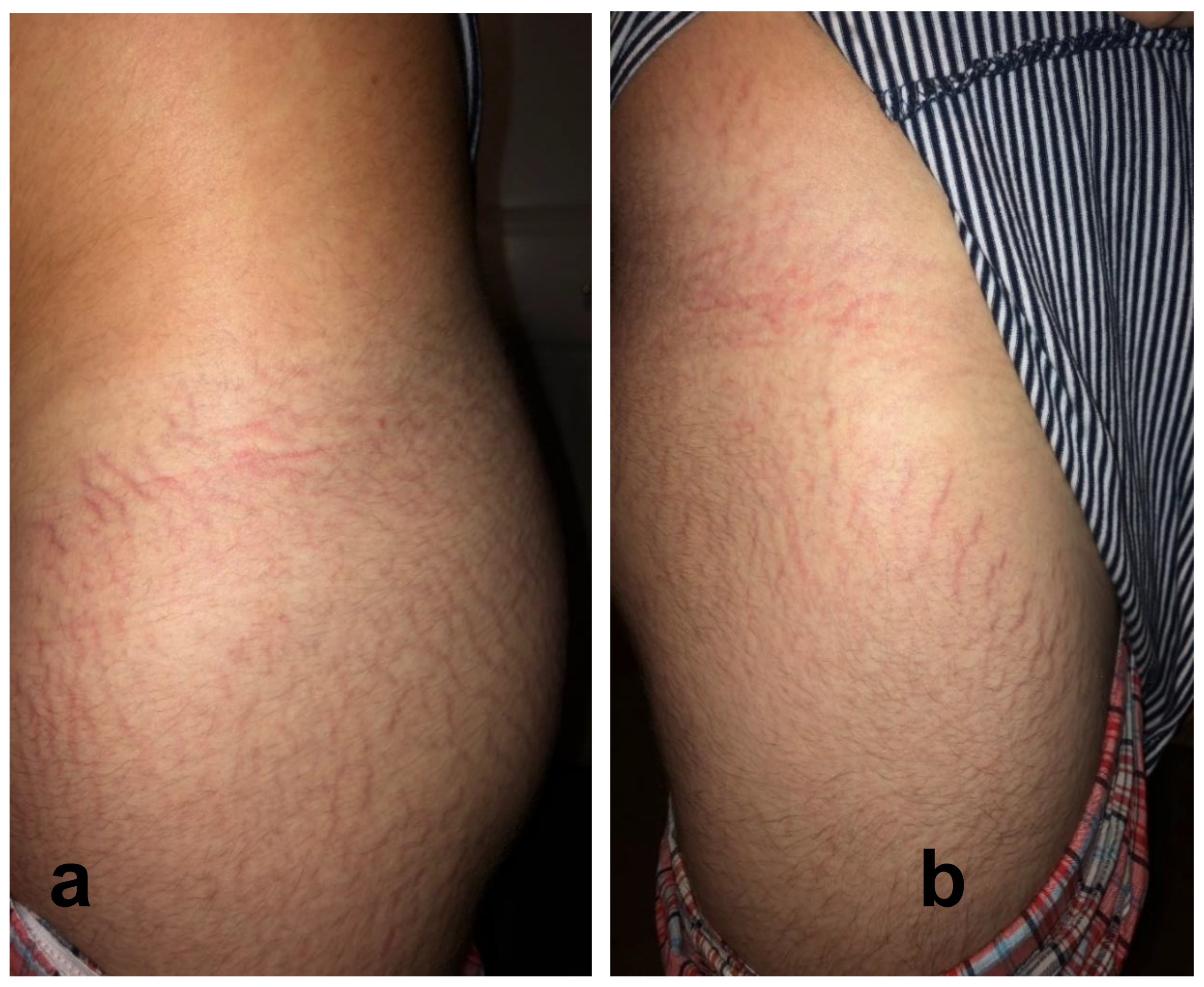 Pathogens 09 01023 g001 Pathogens 09 01023 g001