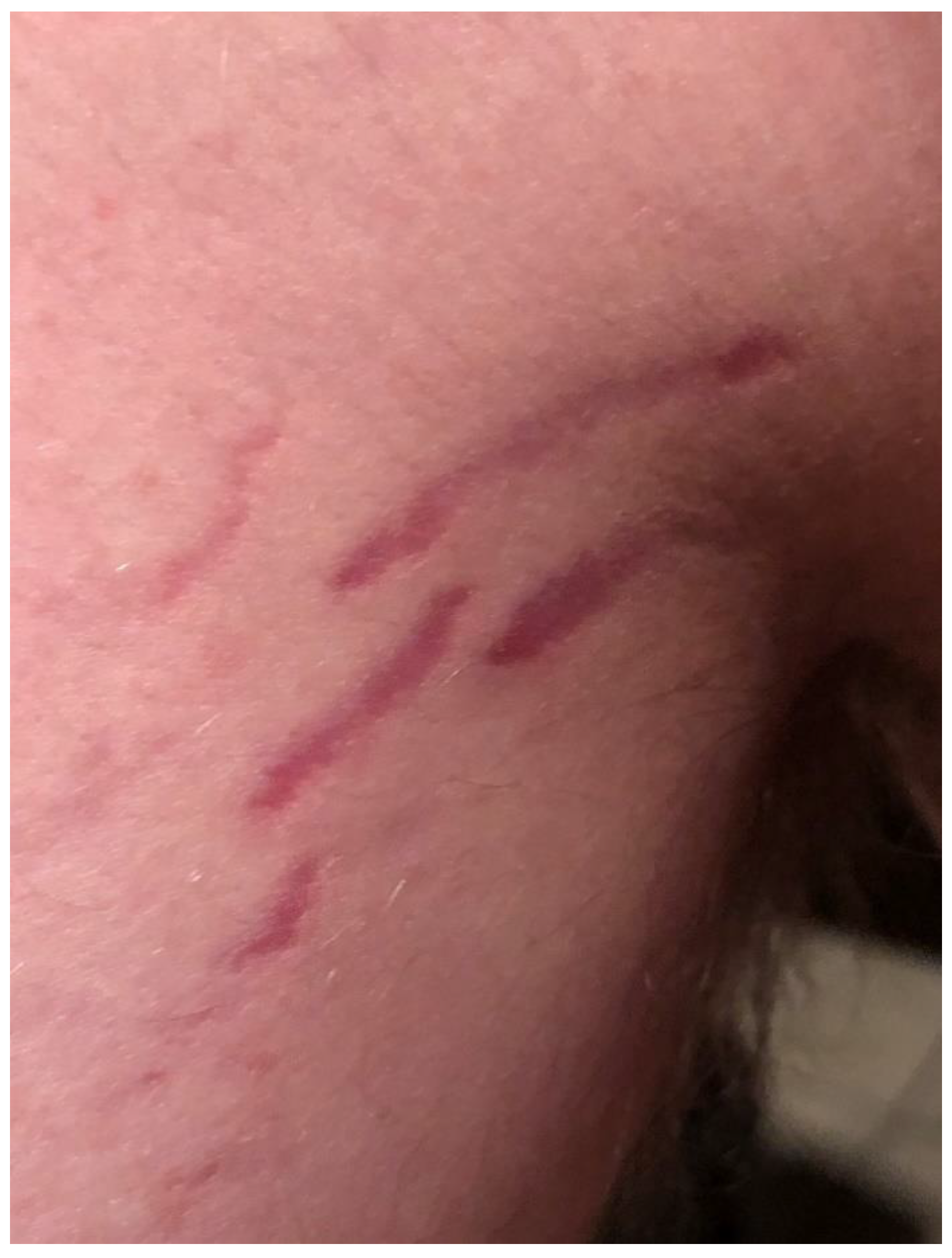 Pathogens 09 01023 g005 Pathogens 09 01023 g005