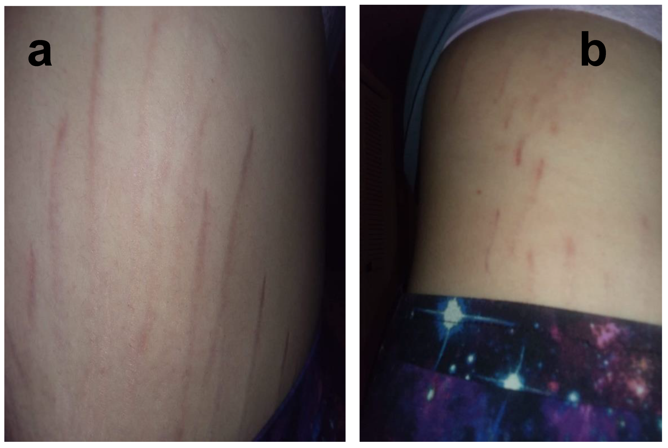 Pathogens 09 01023 g006 Pathogens 09 01023 g006