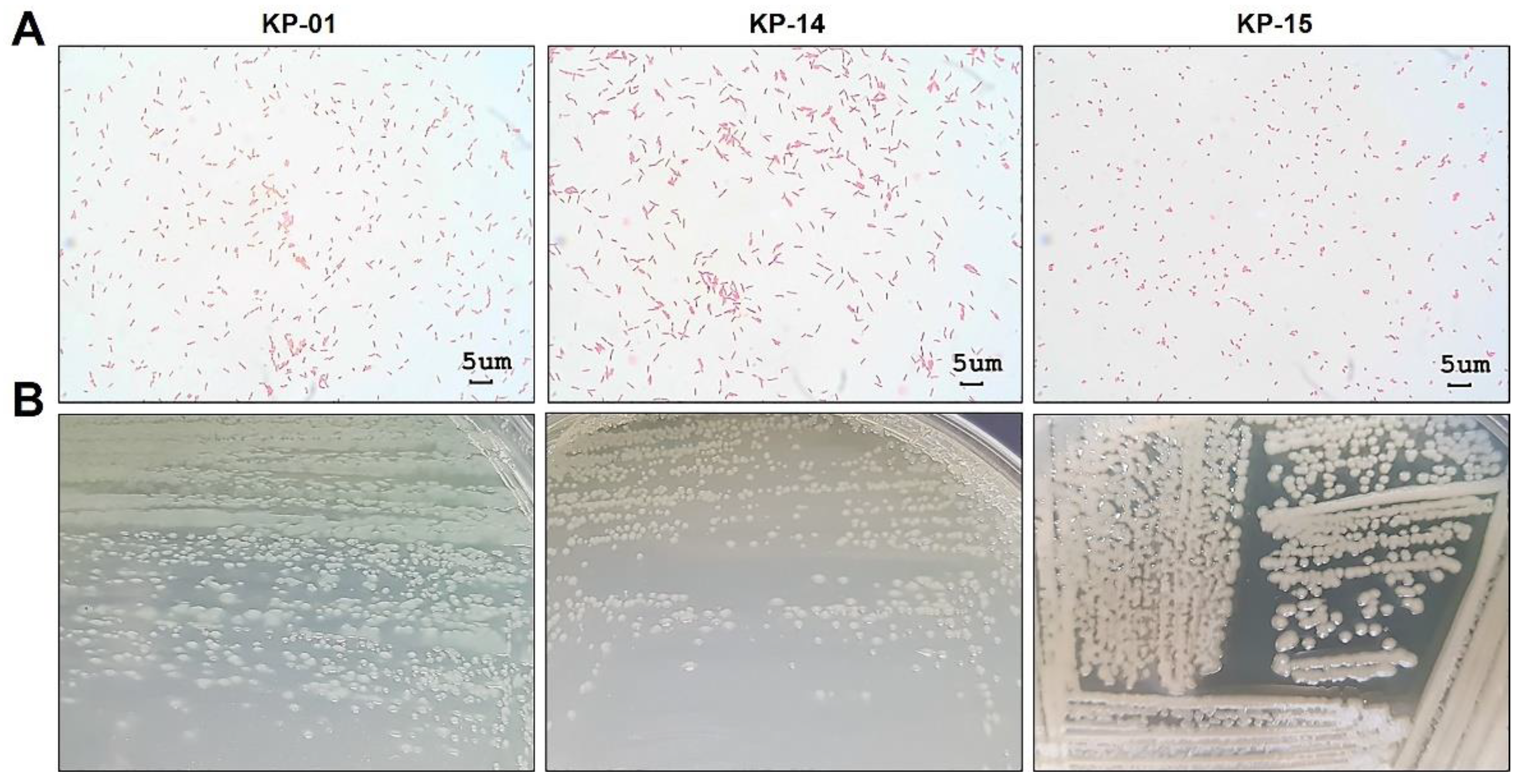 Pathogens 10 00142 g004