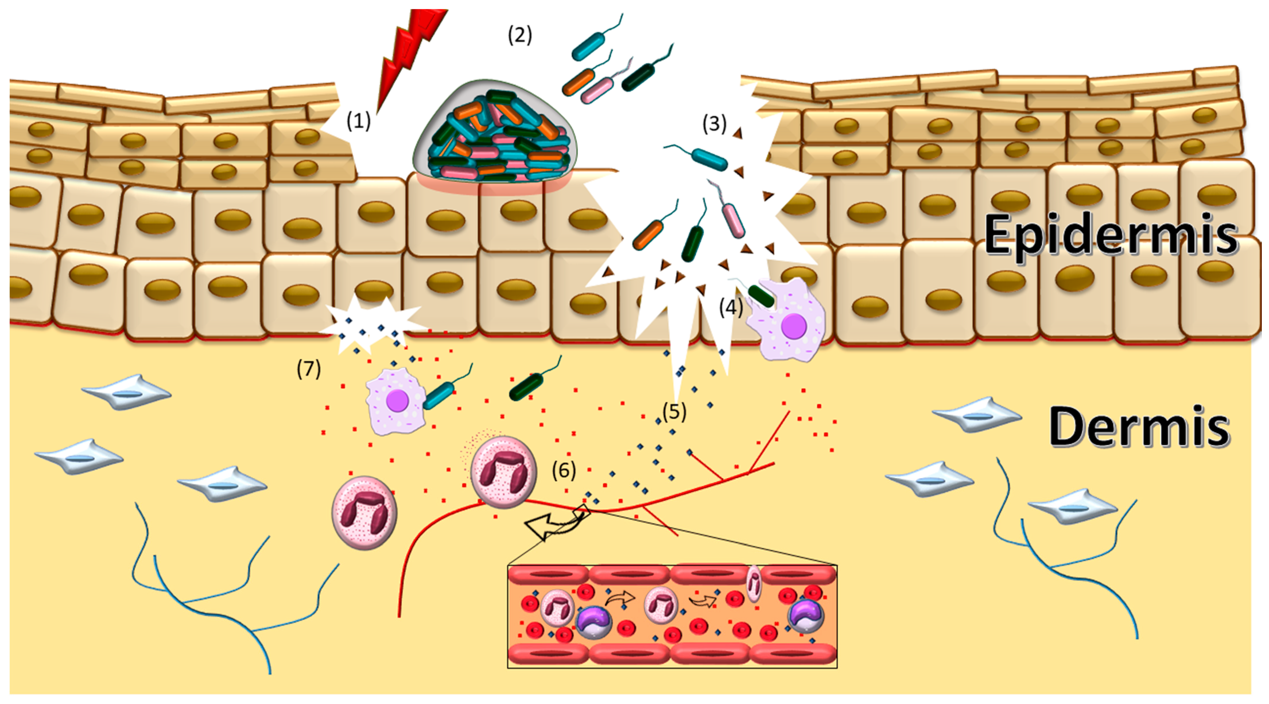 Adipocytes Armed against Staphylococcus aureus