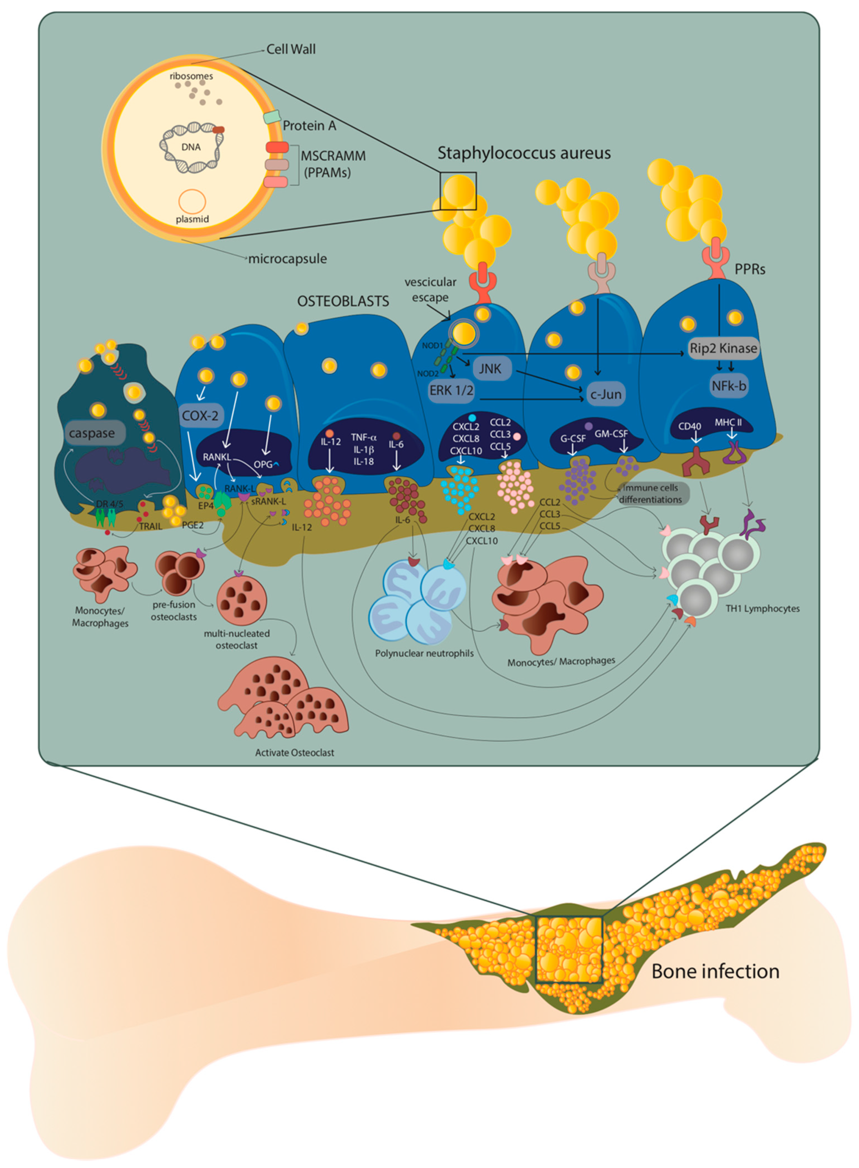 Interaction of Staphylococcus aureus and Host Cells upon Infection of  Bronchial Epithelium during Different Stages of Regeneration