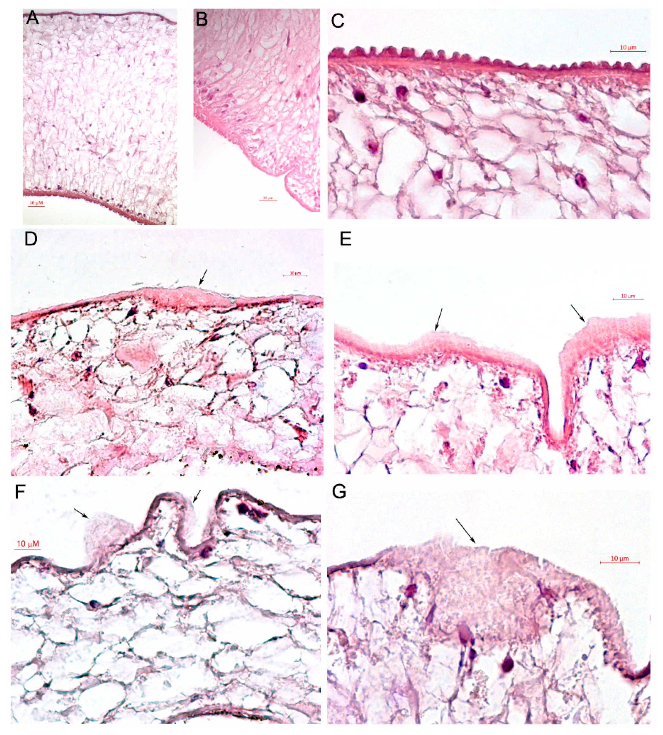 anthelmintic activity against liver fluke medicament bun pentru a preveni viermii