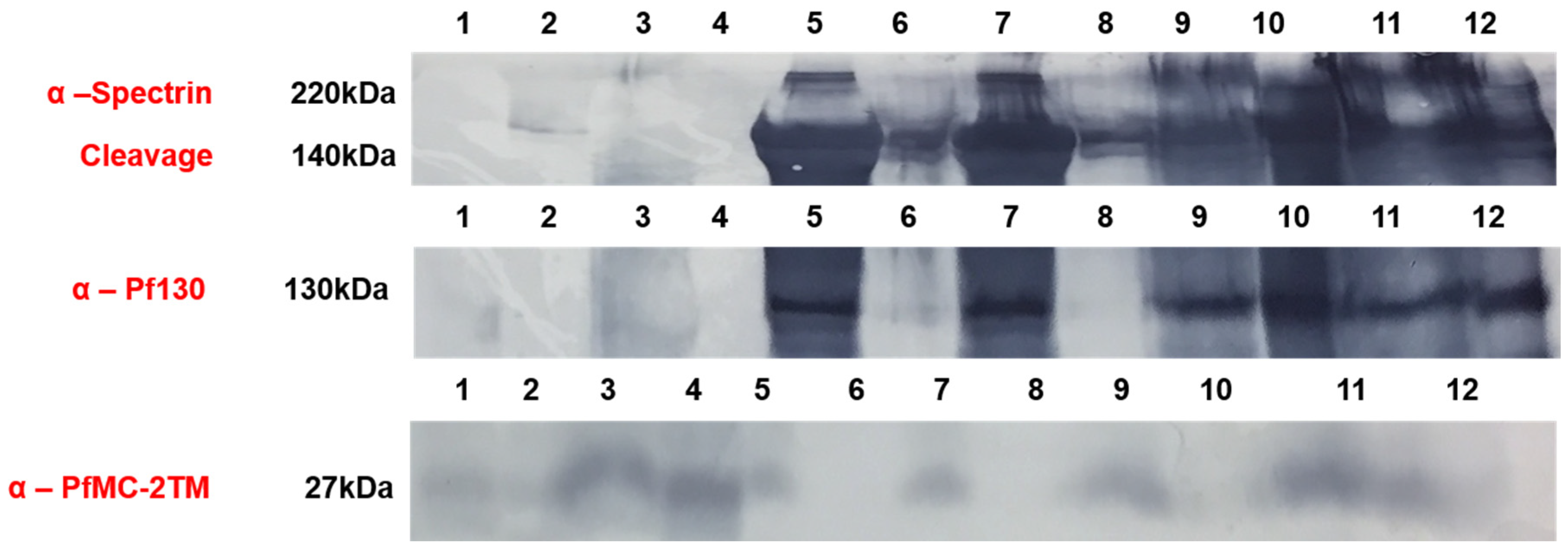 Pathogens 10 00431 g008 Pathogens 10 00431 g008