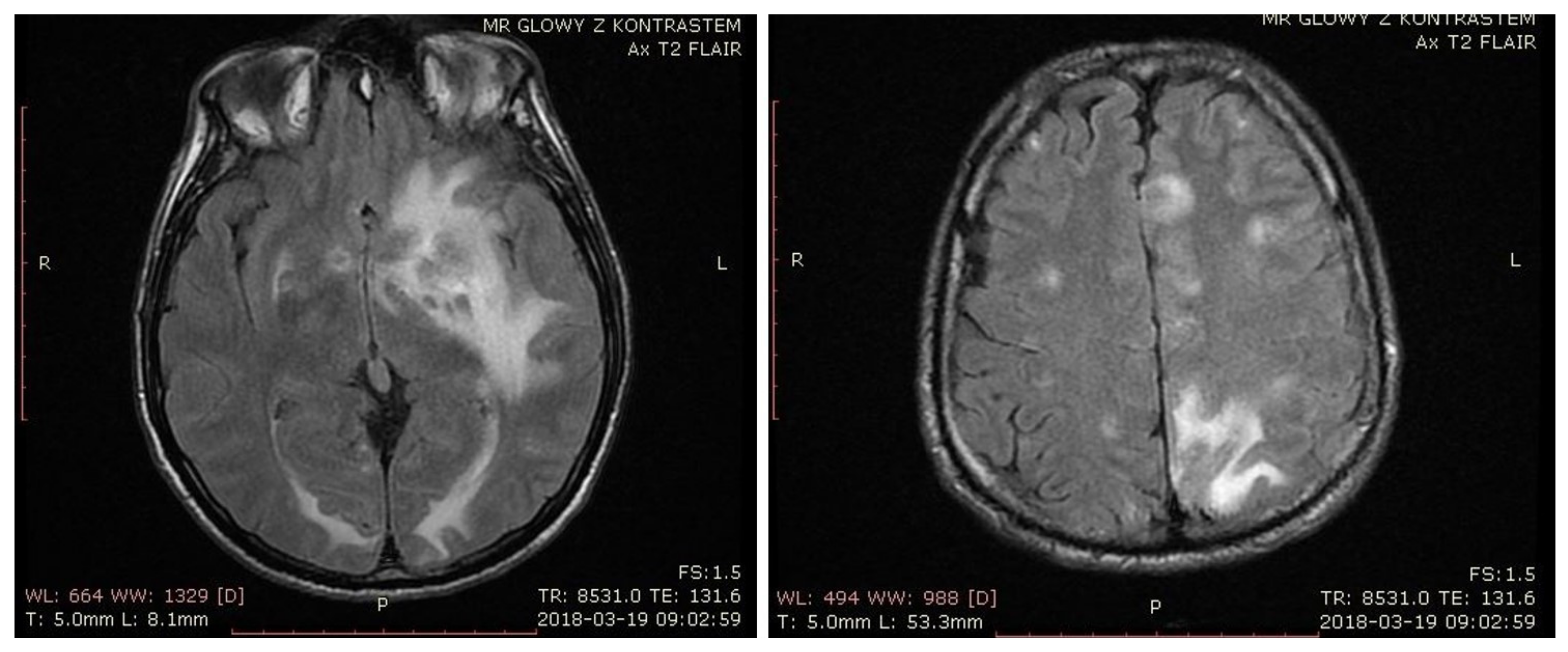Pathogens 10 00497 g001