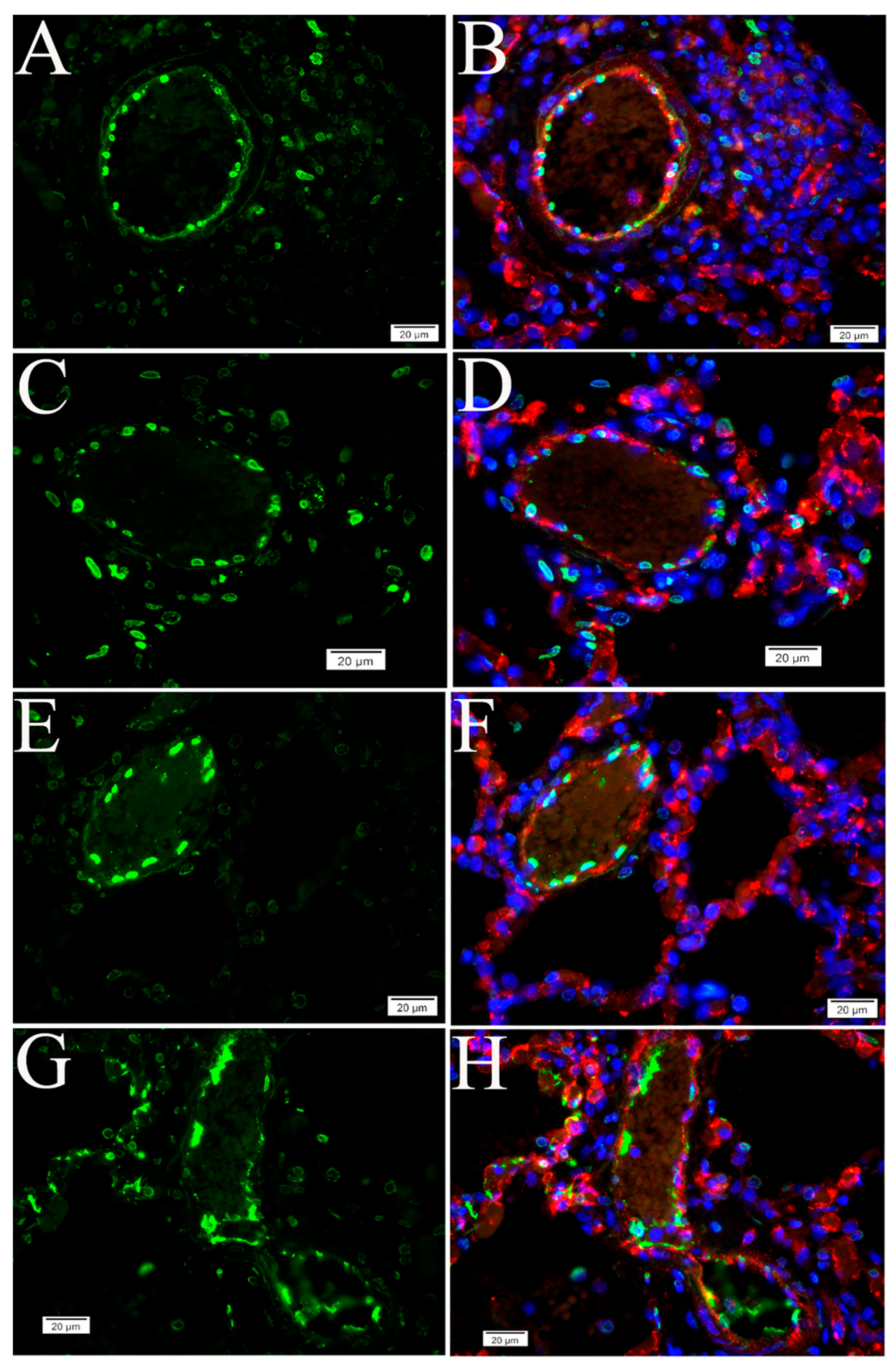 Pathogens 10 00509 g005 Pathogens 10 00509 g005