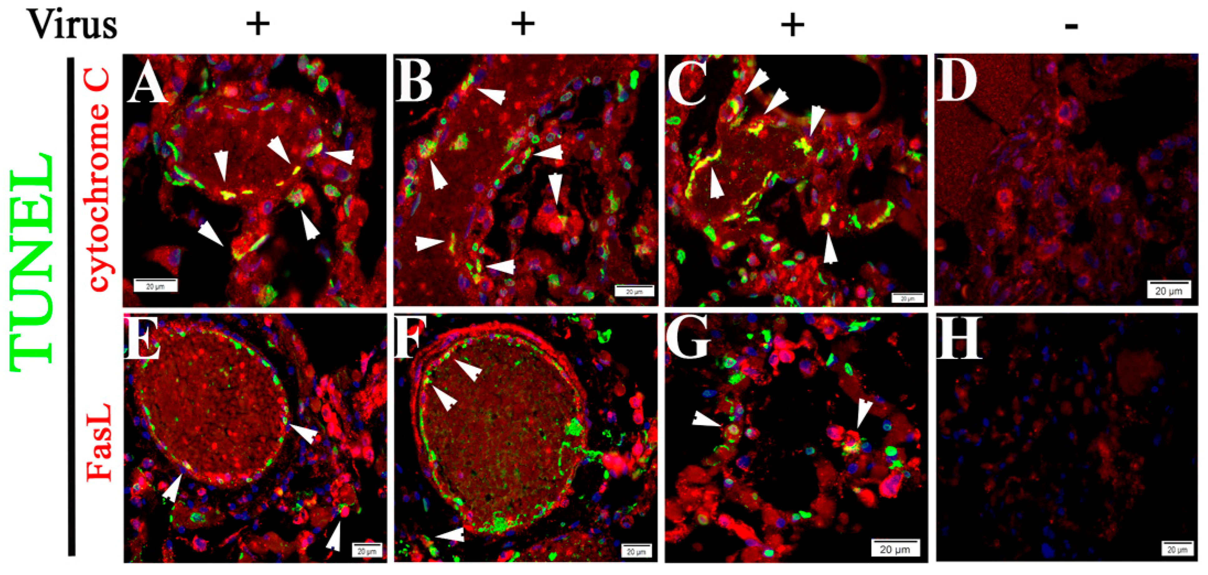 Pathogens 10 00509 g007 Pathogens 10 00509 g007