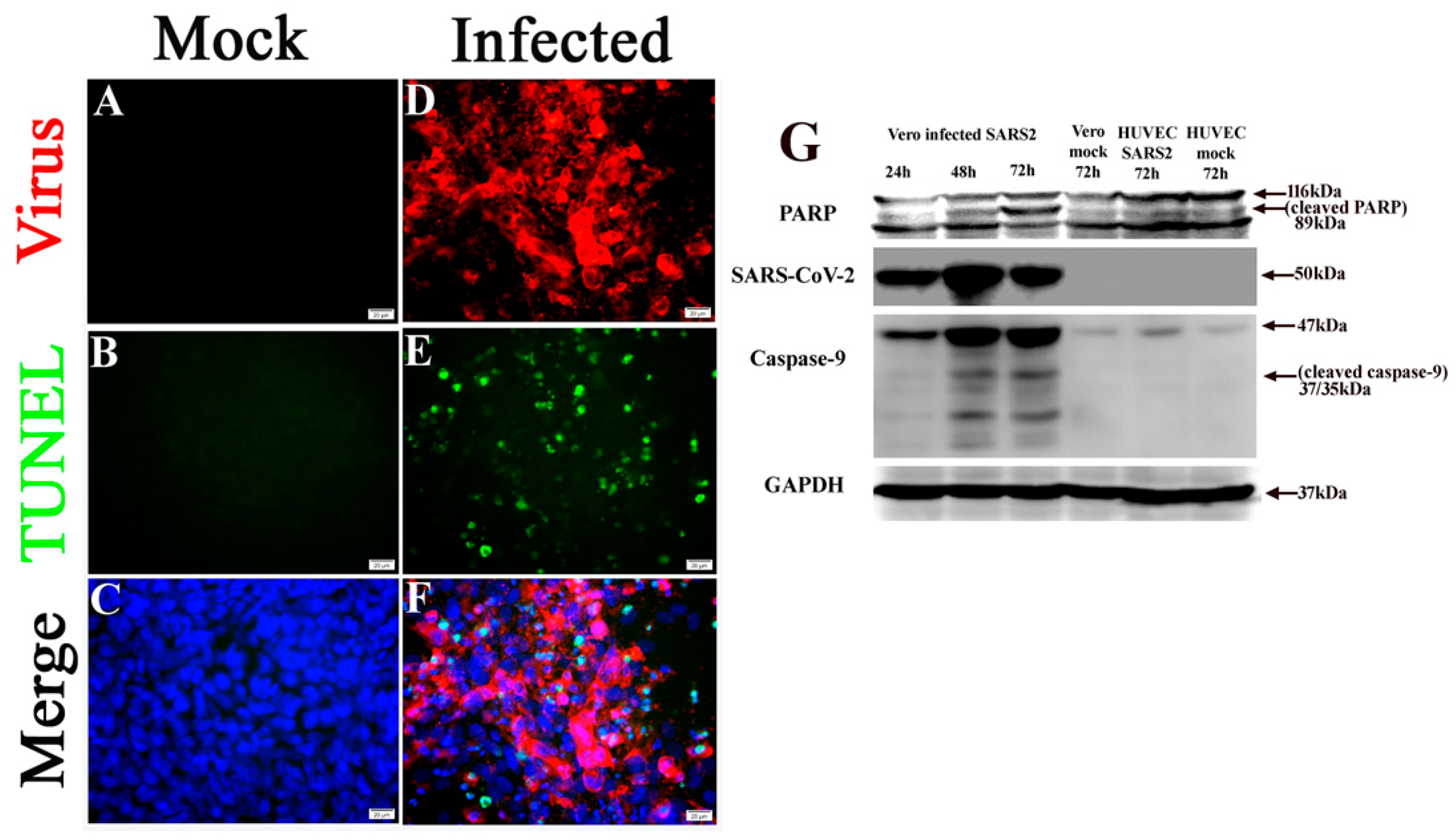 Pathogens 10 00509 g008 Pathogens 10 00509 g008