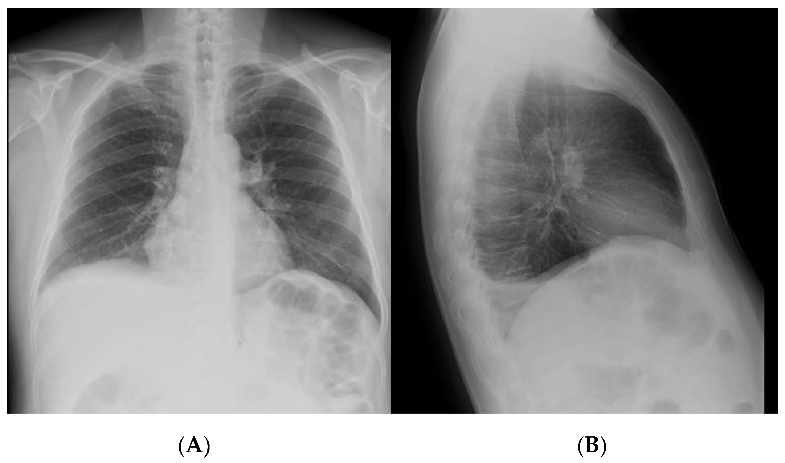 Pathogens 10 00535 g001