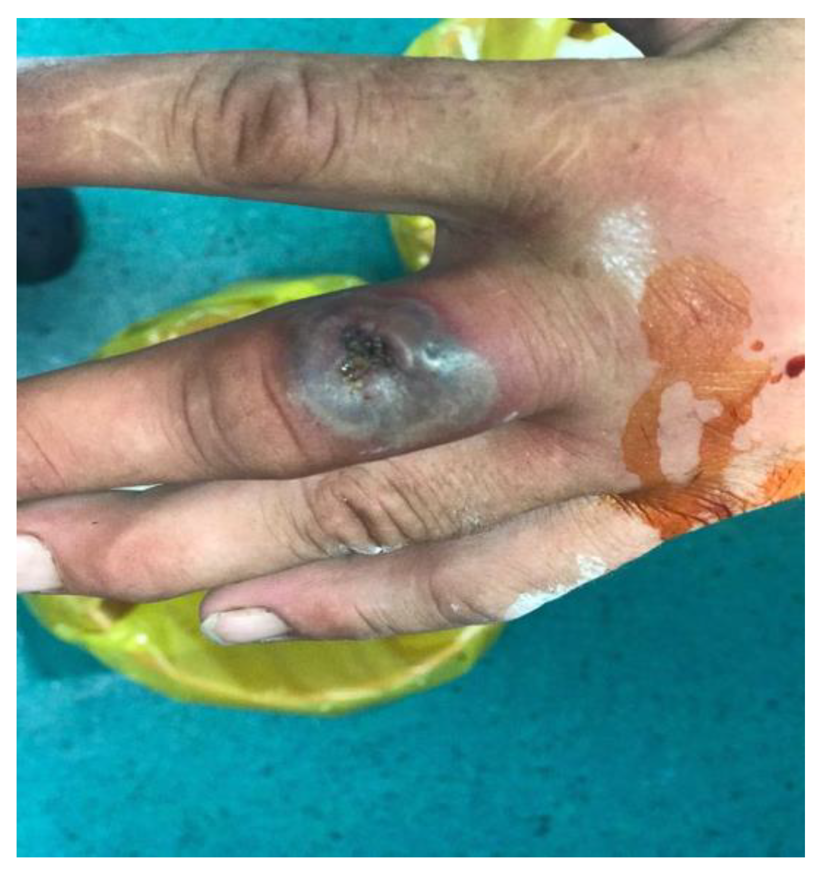 Pathogens 10 00644 g001