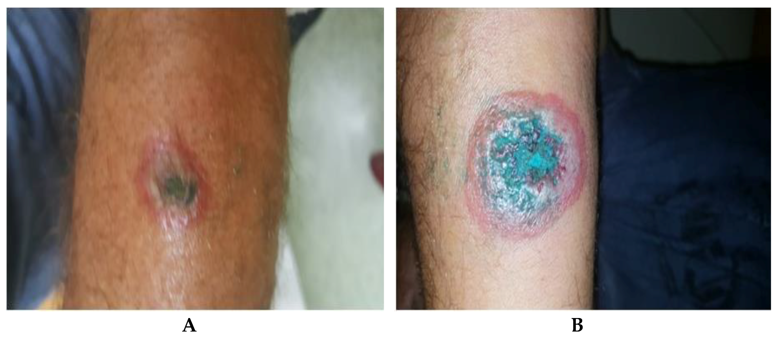 Pathogens 10 00644 g005