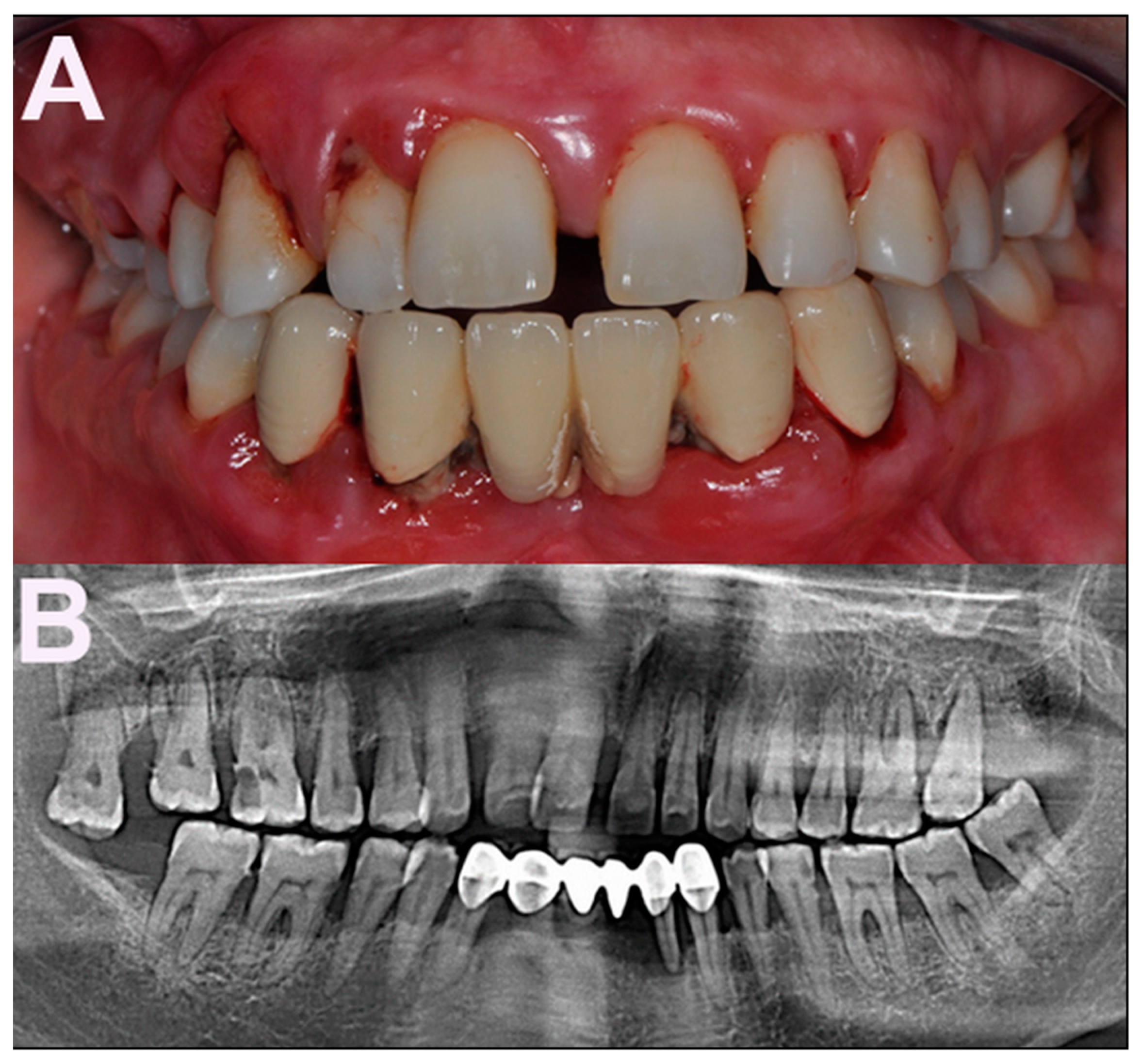 Pathogens 10 00675 g001 Pathogens 10 00675 g001