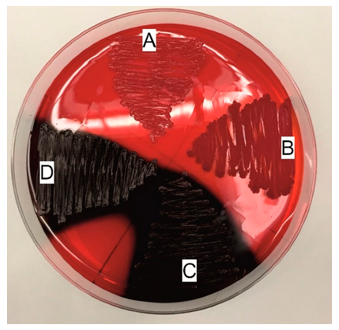 svovl Frastøde Skygge Pathogens | Free Full-Text | Evaluation of Biofilm Formation and Prevalence  of Multidrug-Resistant Strains of Staphylococcus epidermidis Isolated from  Neonates with Sepsis in Southern Poland