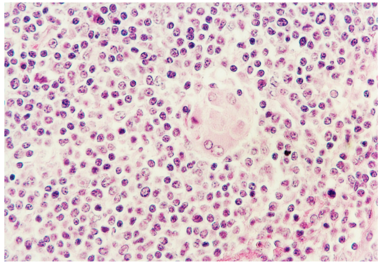 Pathogens 10 00979 g005 550