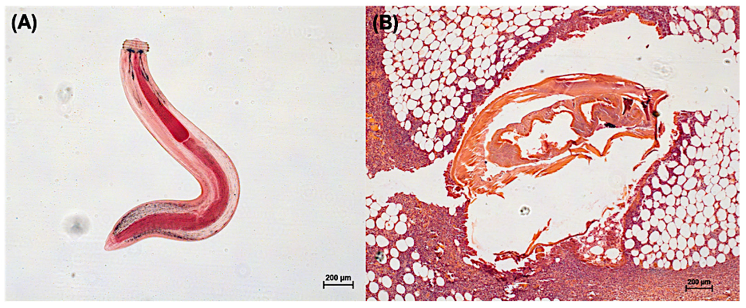 Pathogens Free Full Text Proteomics Of Gnathostomiasis A Way Forward For Diagnosis And Treatment Development Html