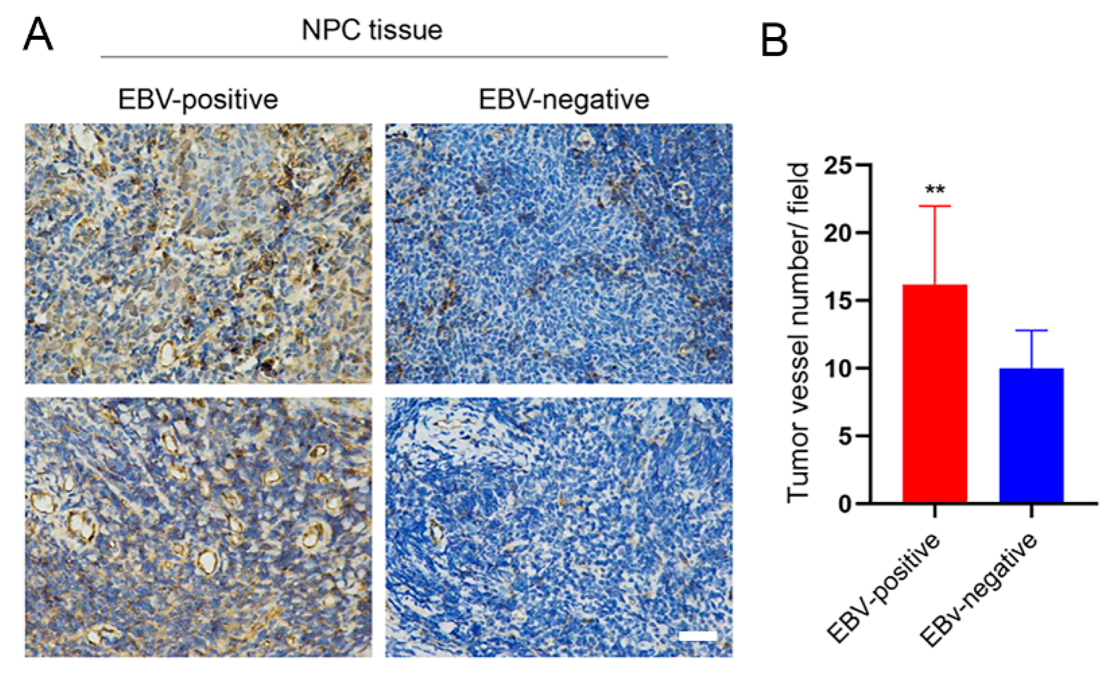 Pathogens 10 01275 g004 Pathogens 10 01275 g004