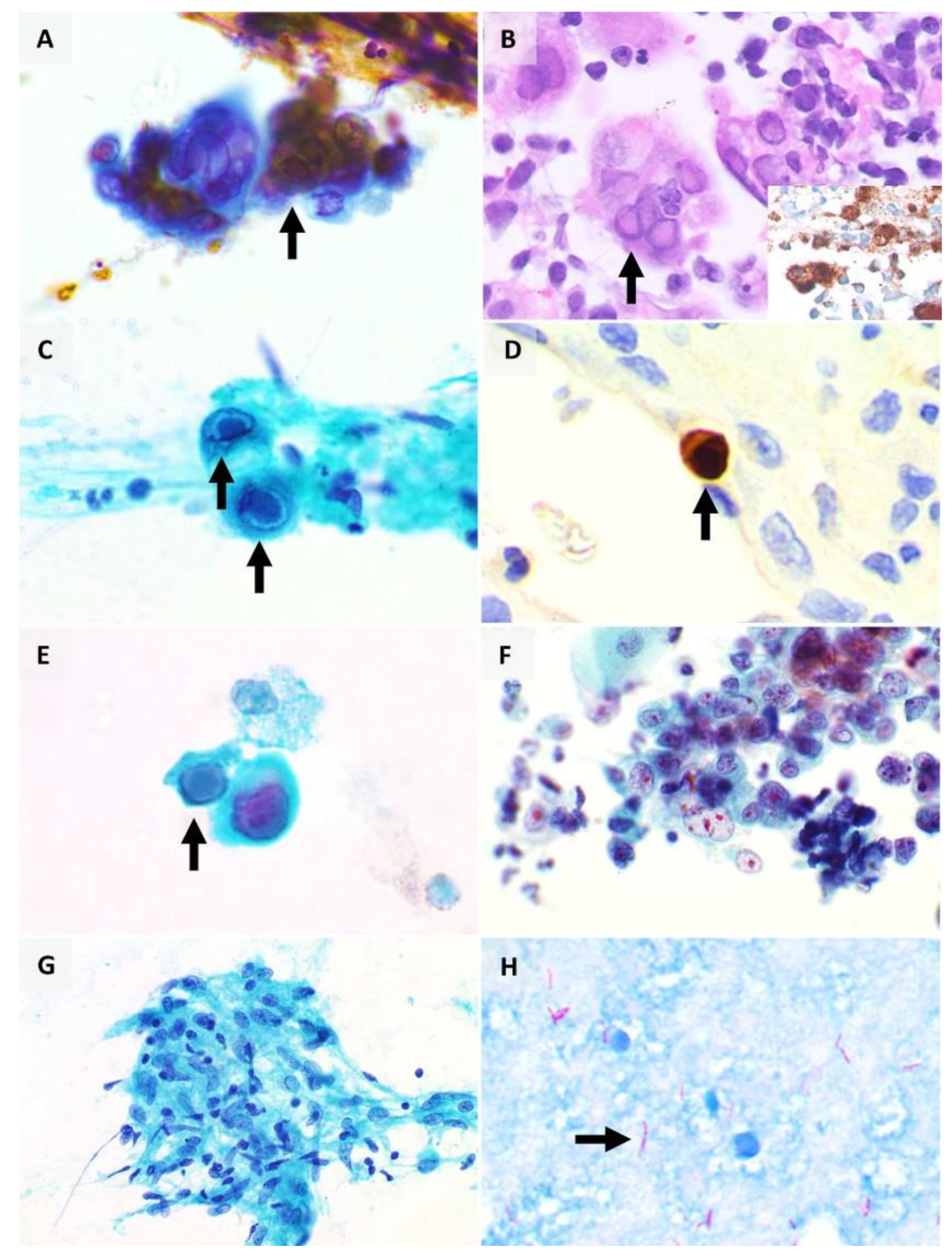Pathogens 10 01410 g002 Pathogens 10 01410 g002