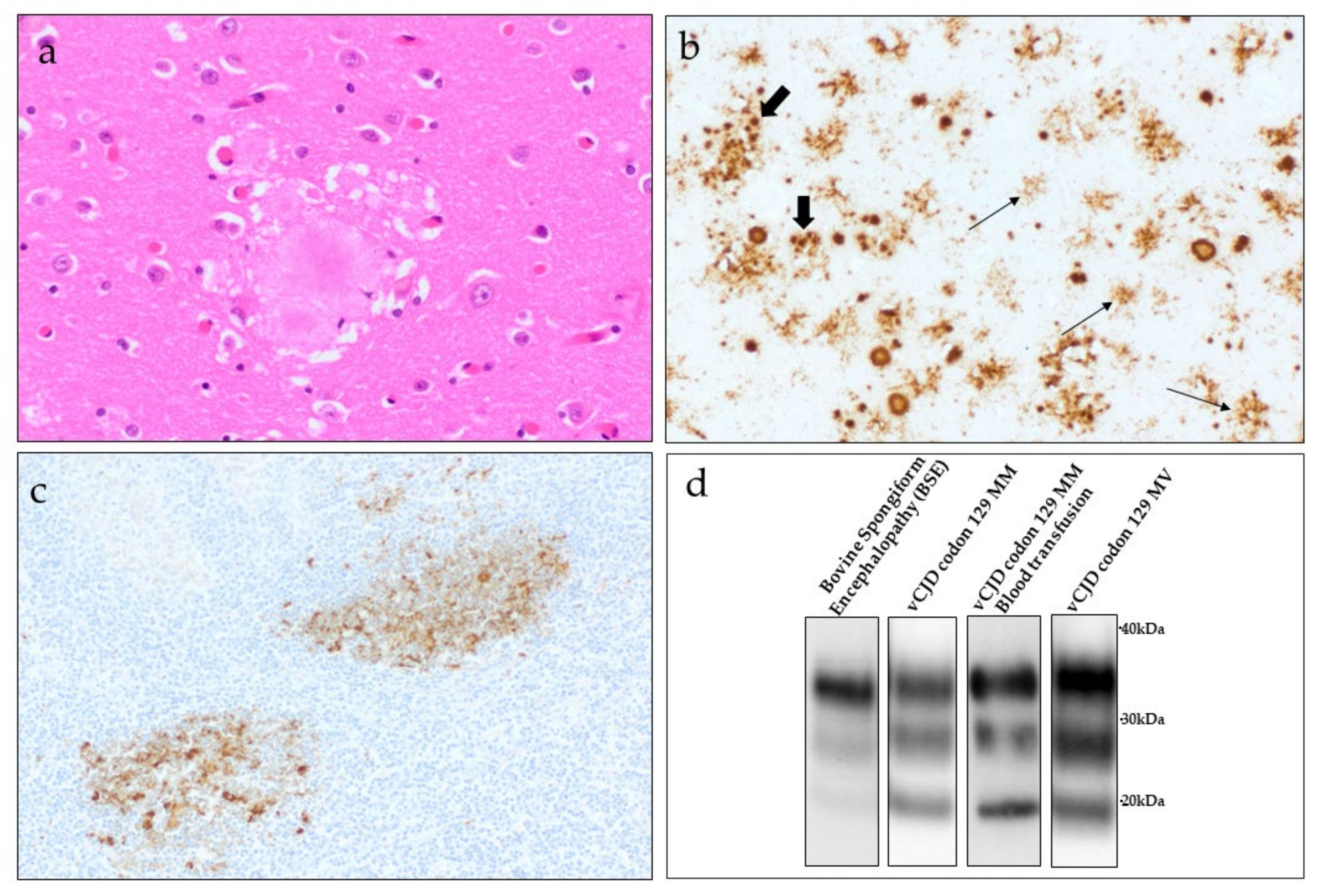 Pathogens 10 01413 g004 Pathogens 10 01413 g004