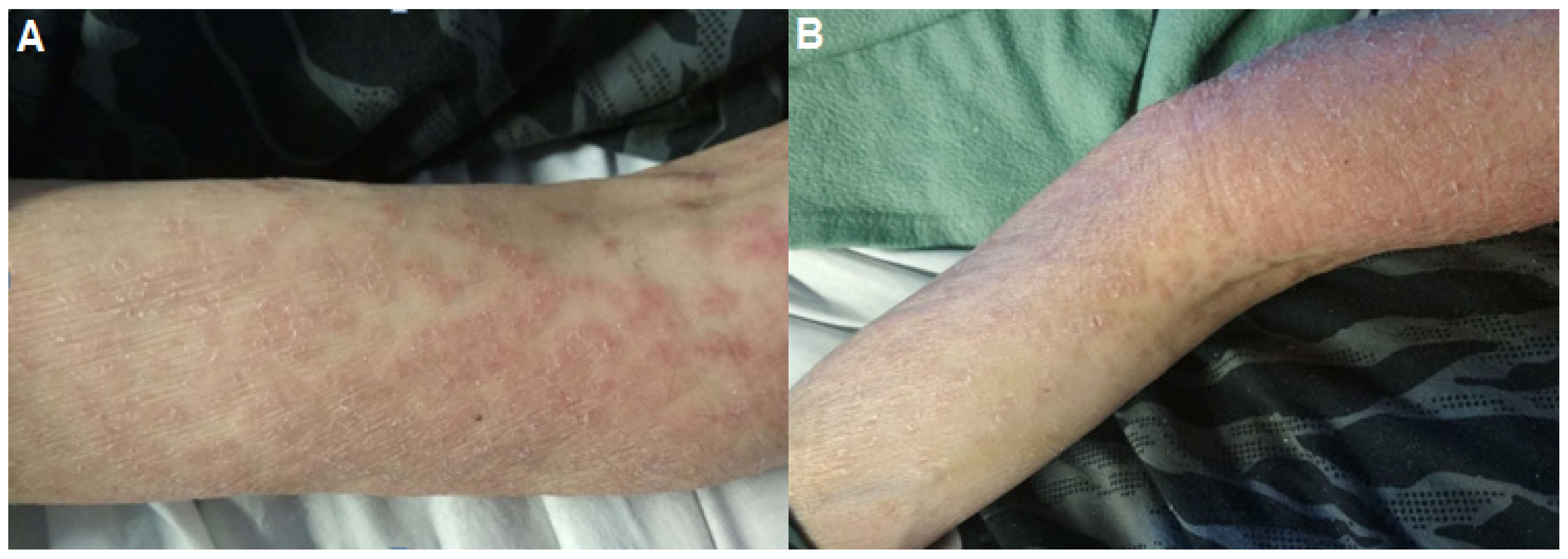 Pathogens 10 01438 g001 Pathogens 10 01438 g001