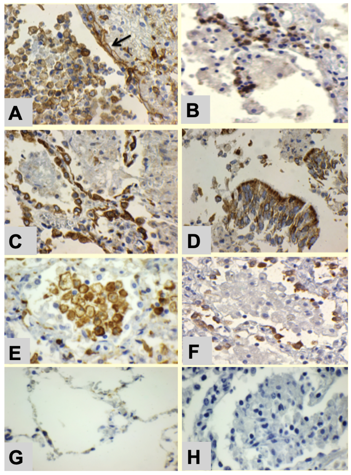 Pathogens 10 01572 g002