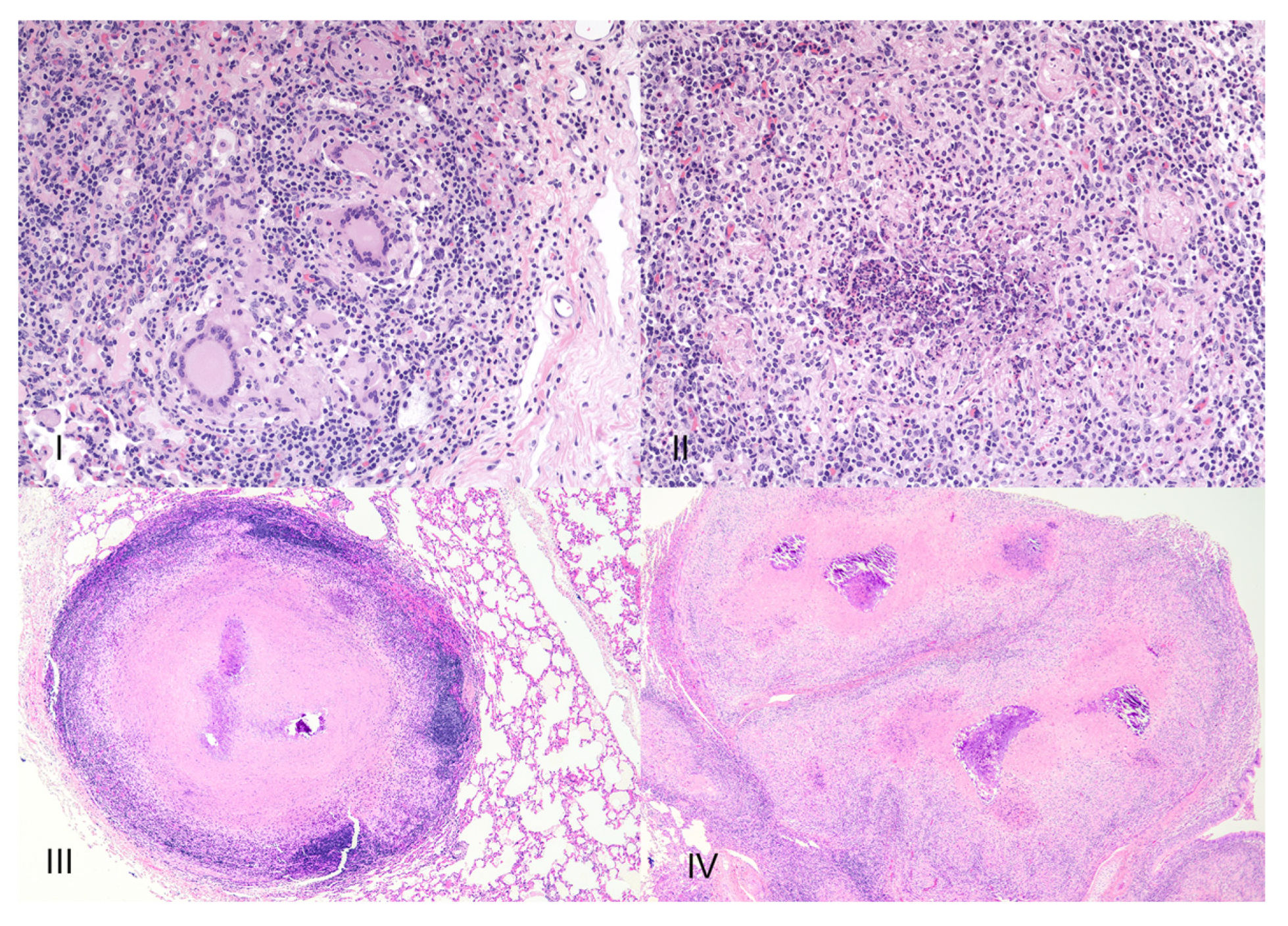Pathogens | Free Full-Text | The Bovine Tuberculoid Granuloma Pathogens | Free Full-Text | The Bovine Tuberculoid Granuloma