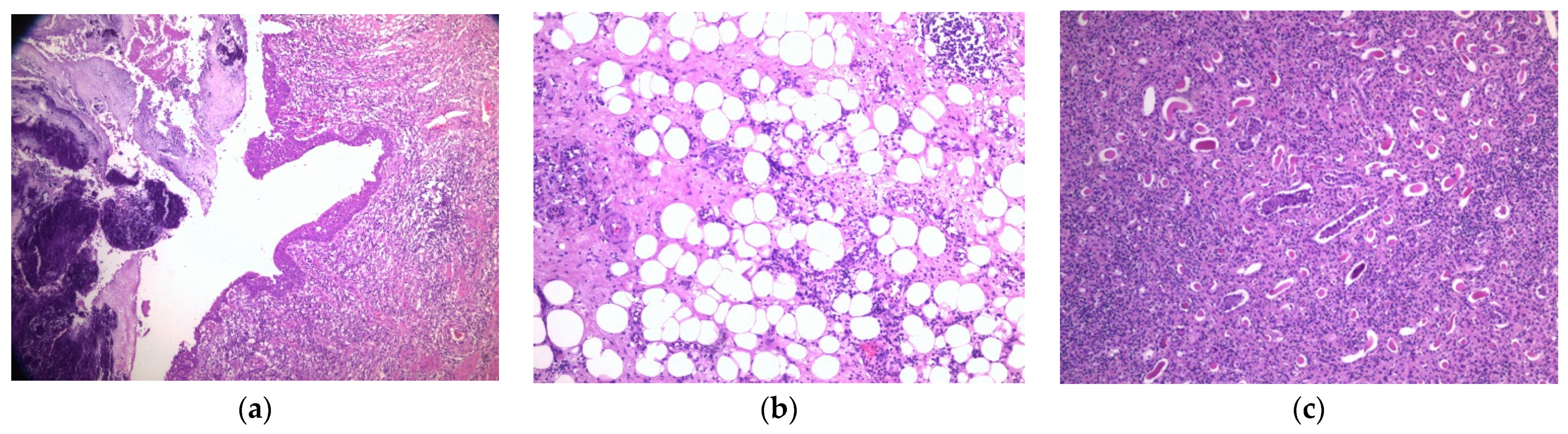 Pathogens 11 00081 g004 Pathogens 11 00081 g004