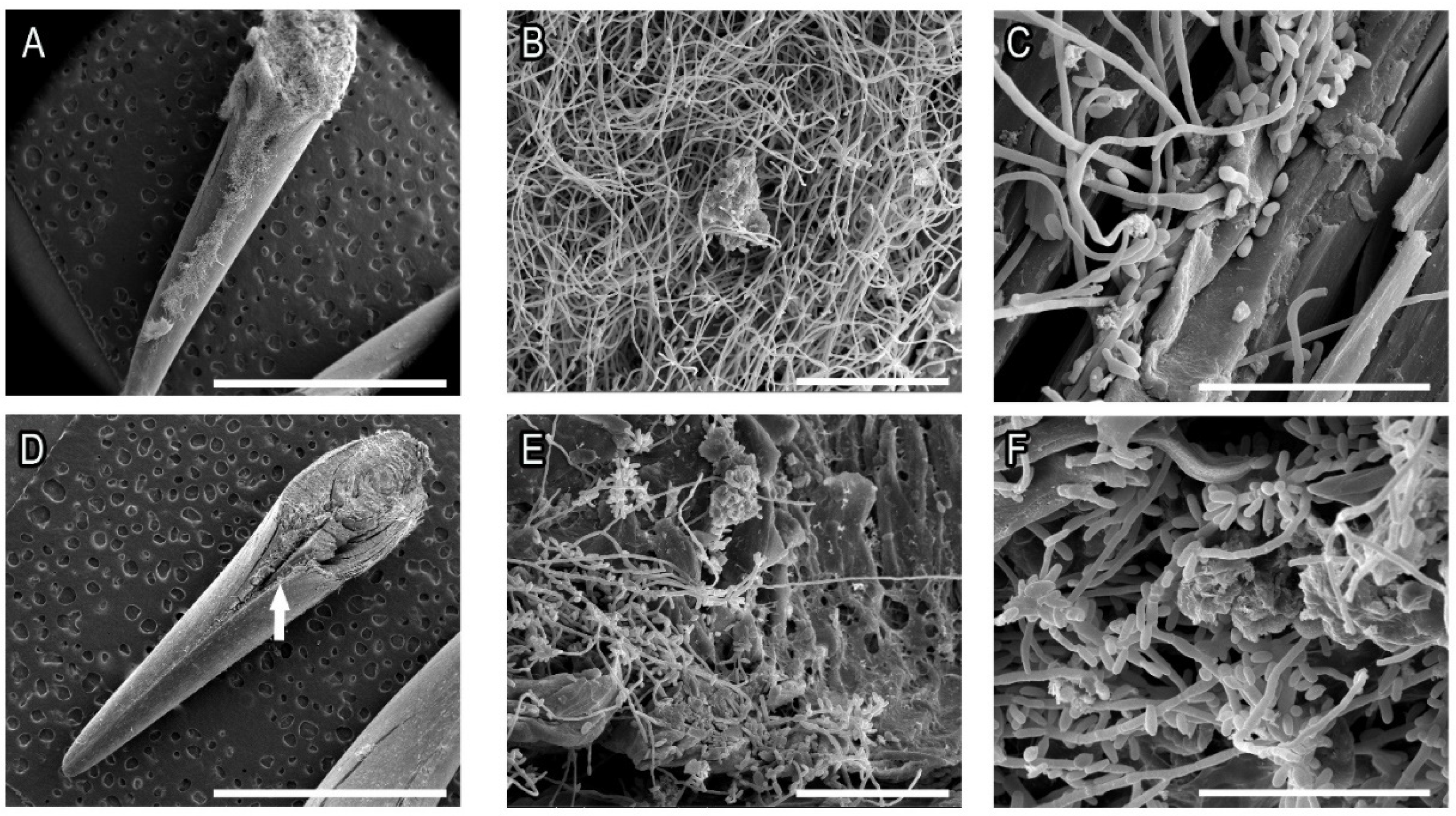 Pathogens 11 00206 g004