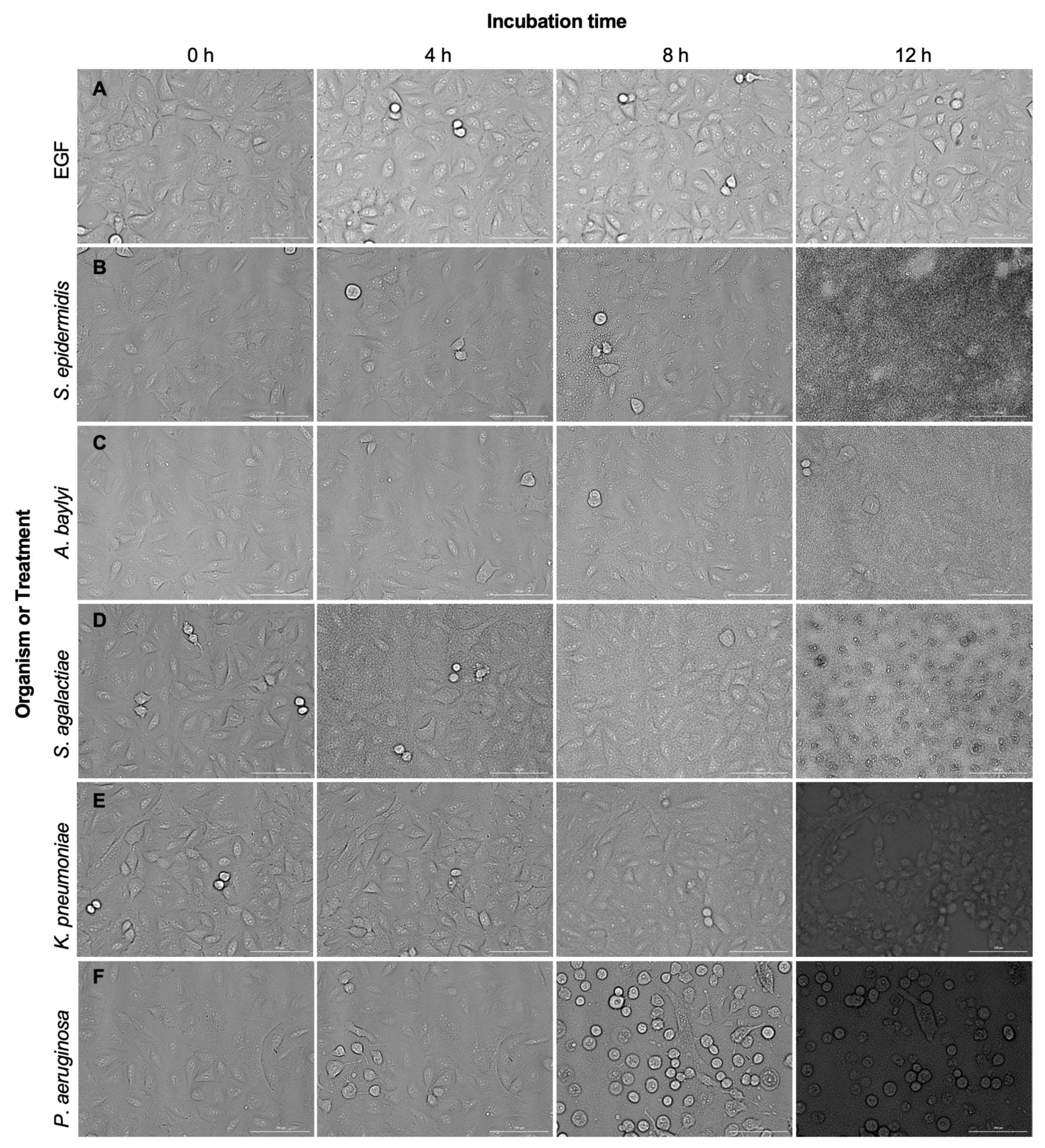 Pathogens 11 00209 g005 550