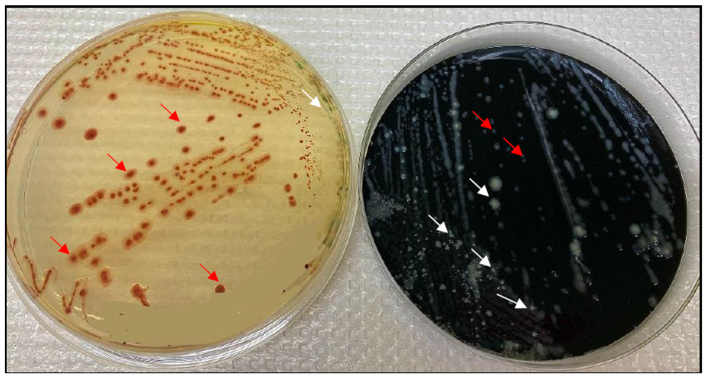 Pathogens Free FullText Campylobacteriosis, Shigellosis and