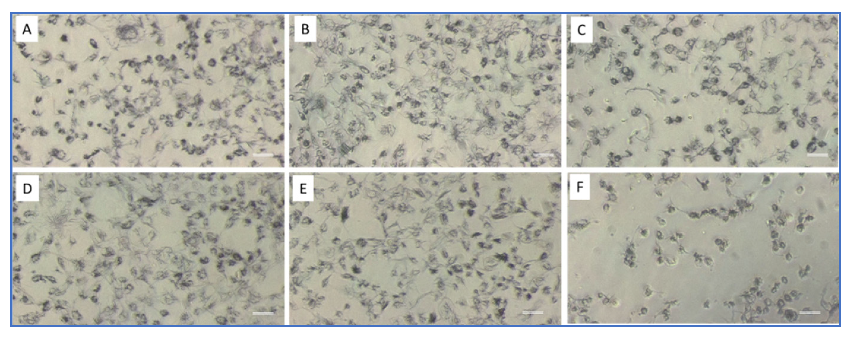 Pathogens 11 00267 g004