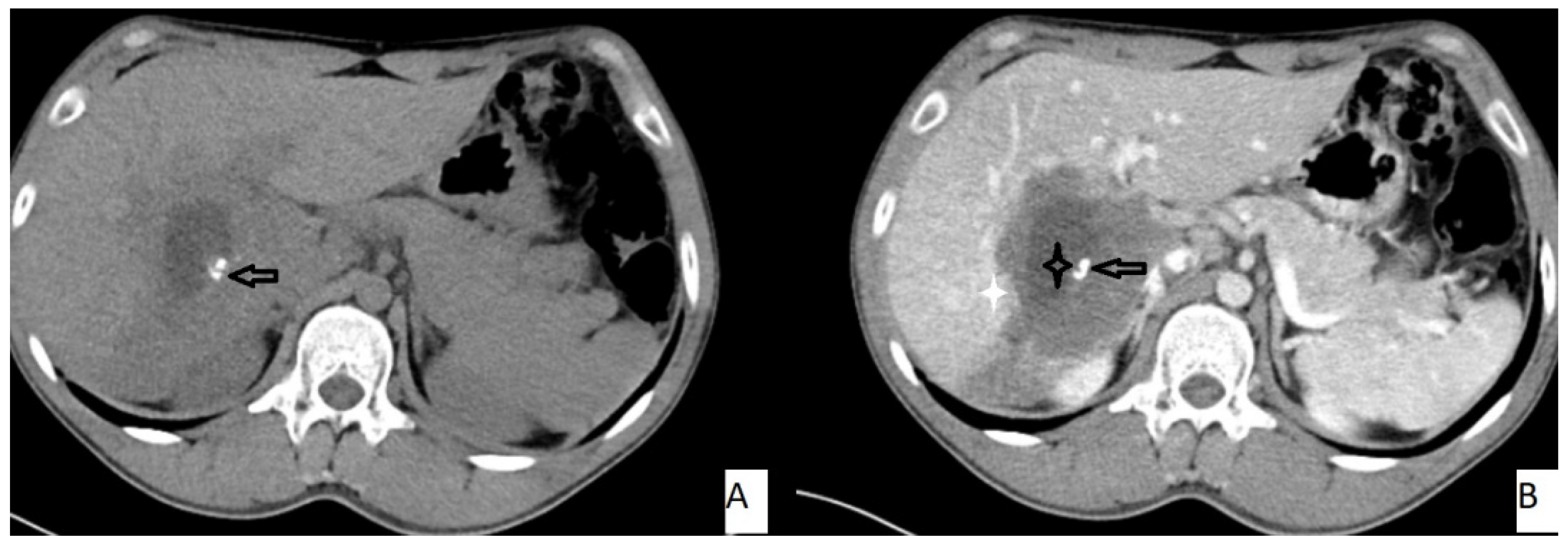 Pathogens 11 00276 g003 550