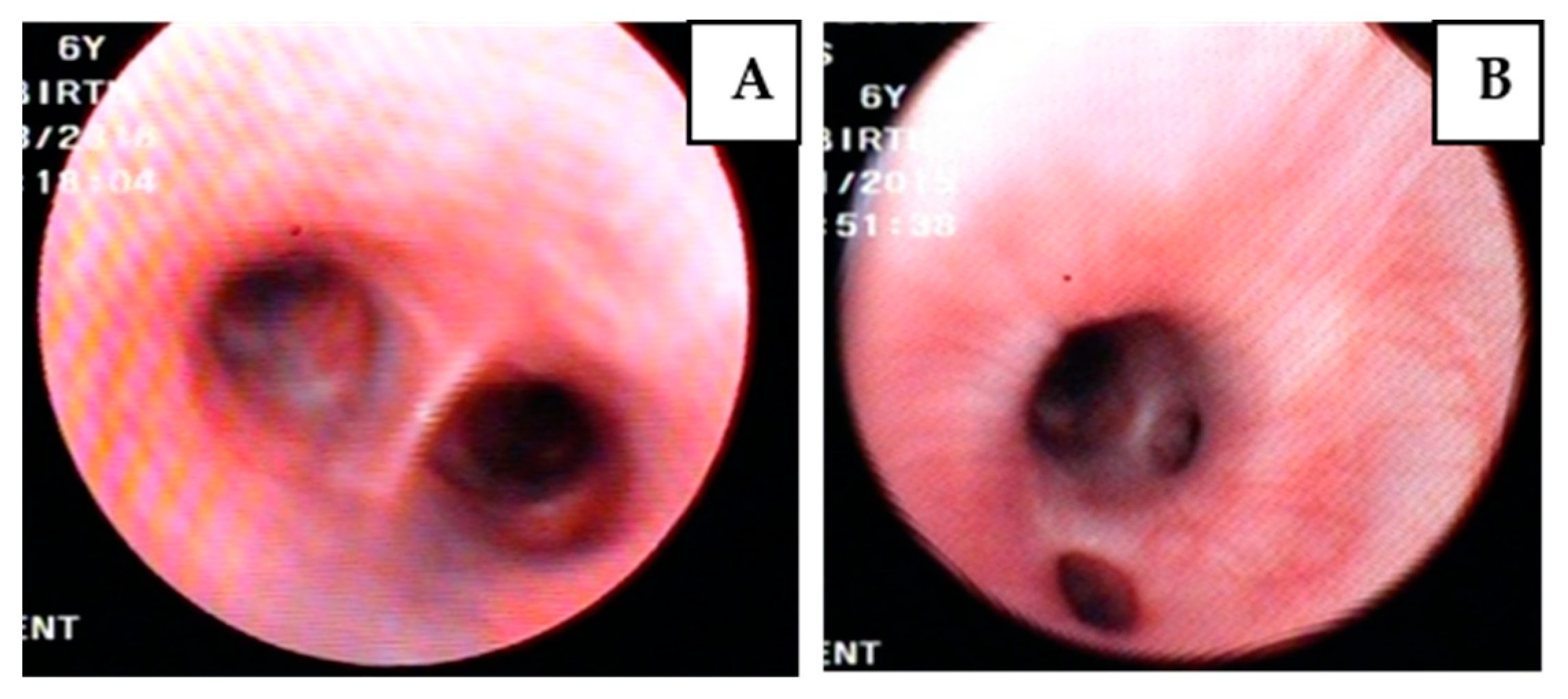 Pathogens 11 00365 g001