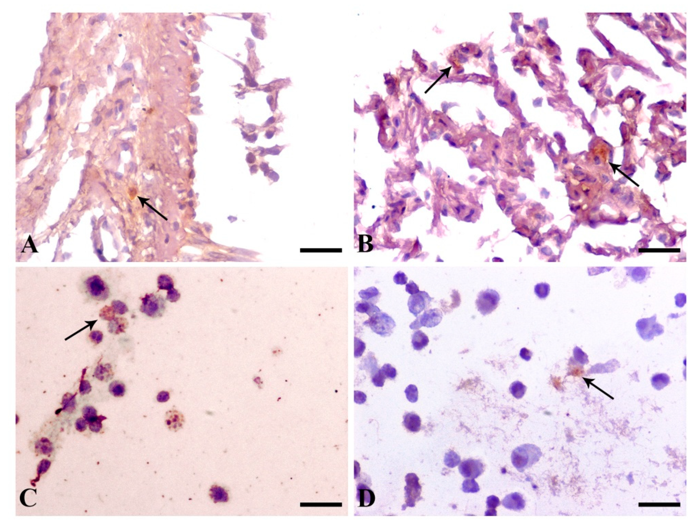 Pathogens 11 00365 g004