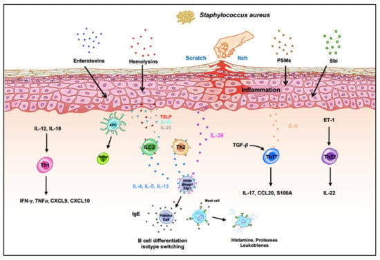 Taming Staphylococcus aureus in the eczema skin microbiome